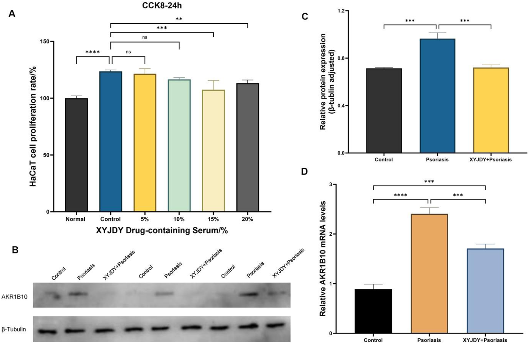 Four panels illustrating experiments on HaCaT cell proliferation and protein expression. Panel A: Bar chart shows HaCaT cell proliferation rates with different concentrations of XYJDY serum, indicating significant differences. Panel B: Western blot images for control, psoriasis, and XYJDY treatments, showing β-Tubulin and AKR1B10 protein bands. Panel C: Bar chart displays relative protein expression levels, with marked differences between control, psoriasis, and XYJDY plus psoriasis groups. Panel D: Bar chart shows relative AKR1B10 mRNA levels, demonstrating significant differences between conditions. Statistical significance is indicated with asterisks.