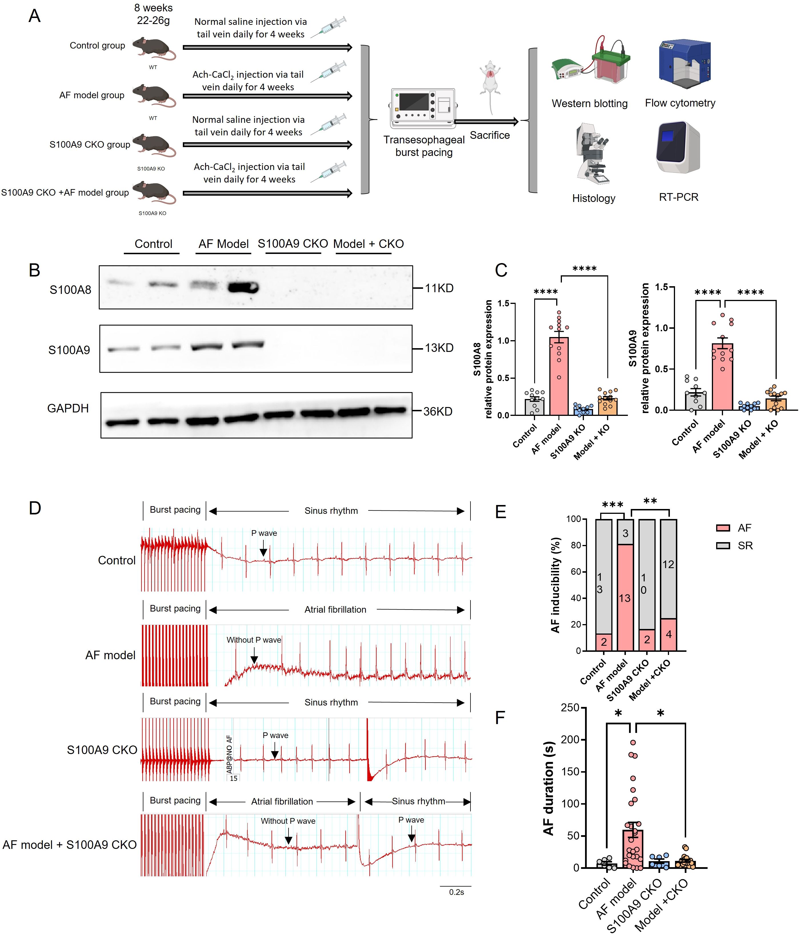 The image contains multiple panels illustrating a scientific study on atrial fibrillation (AF). Panel A depicts the experimental design with four groups of mice, including control, AF model, S100A9 CKO, and combined model, undergoing treatments like Ach-CaCl2 injections. Panels B and C display Western blot results and graphs showing expressions of S100A8 and S100A9 proteins. Panel D presents ECG traces indicating sinus rhythm and atrial fibrillation in different groups. Panel E shows a bar graph of AF inducibility percentages. Panel F presents AF duration as a bar graph. Statistical significance is marked with asterisks.