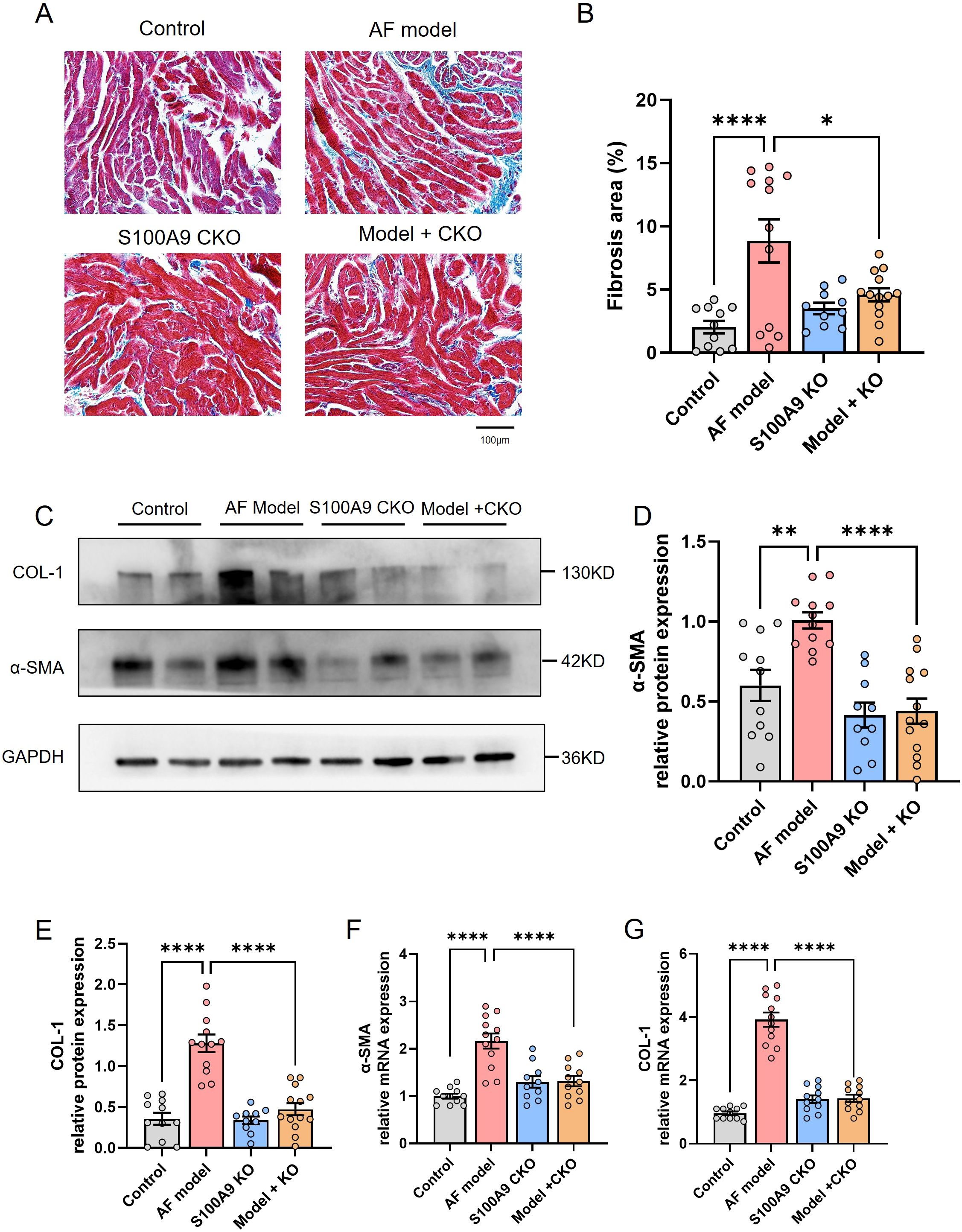 Histology and data visualization comparing experimental groups. Panel A shows stained tissue images from four groups: Control, AF model, S100A9 CKO, and Model + CKO. Panel B presents a bar graph of fibrosis area percentages, highlighting significant differences across groups. Panel C displays Western blot results for COL-1, α-SMA, and GAPDH. Panel D shows a bar graph of relative α-SMA protein expression. Panels E, F, and G illustrate bar graphs for relative protein and mRNA expression of COL-1 and α-SMA. Significant differences are noted with asterisks.