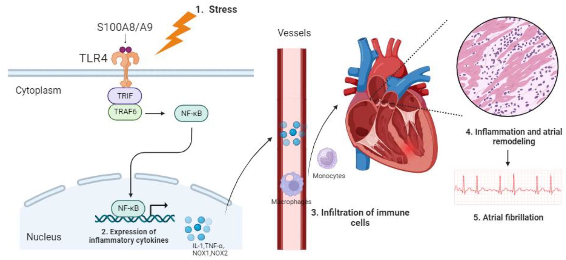 Illustration depicting the process of stress-induced atrial fibrillation. Stress activates the TLR4 pathway, leading to the expression of inflammatory cytokines. This causes immune cell infiltration, including monocytes, into the vessels and heart. The heart undergoes inflammation and atrial remodeling, shown in a magnified cross-section, culminating in atrial fibrillation as indicated on an ECG.