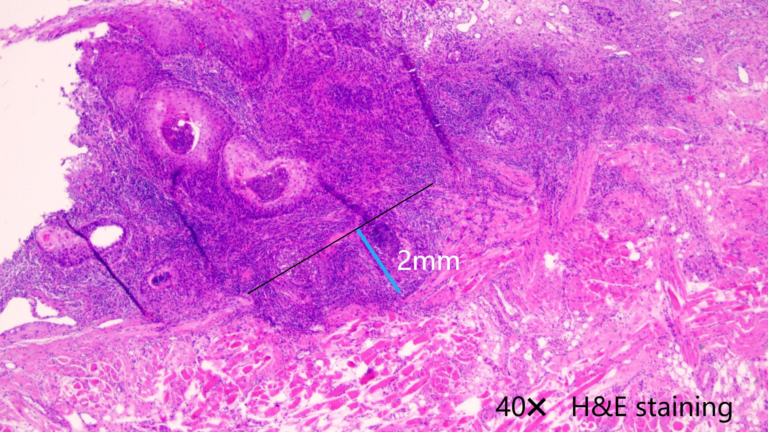 Microscopic image of a tissue sample stained with hematoxylin and eosin (H&E), viewed at 40x magnification. The image shows cellular structures and connective tissues in shades of pink and purple. A scale bar indicates 2 millimeters.