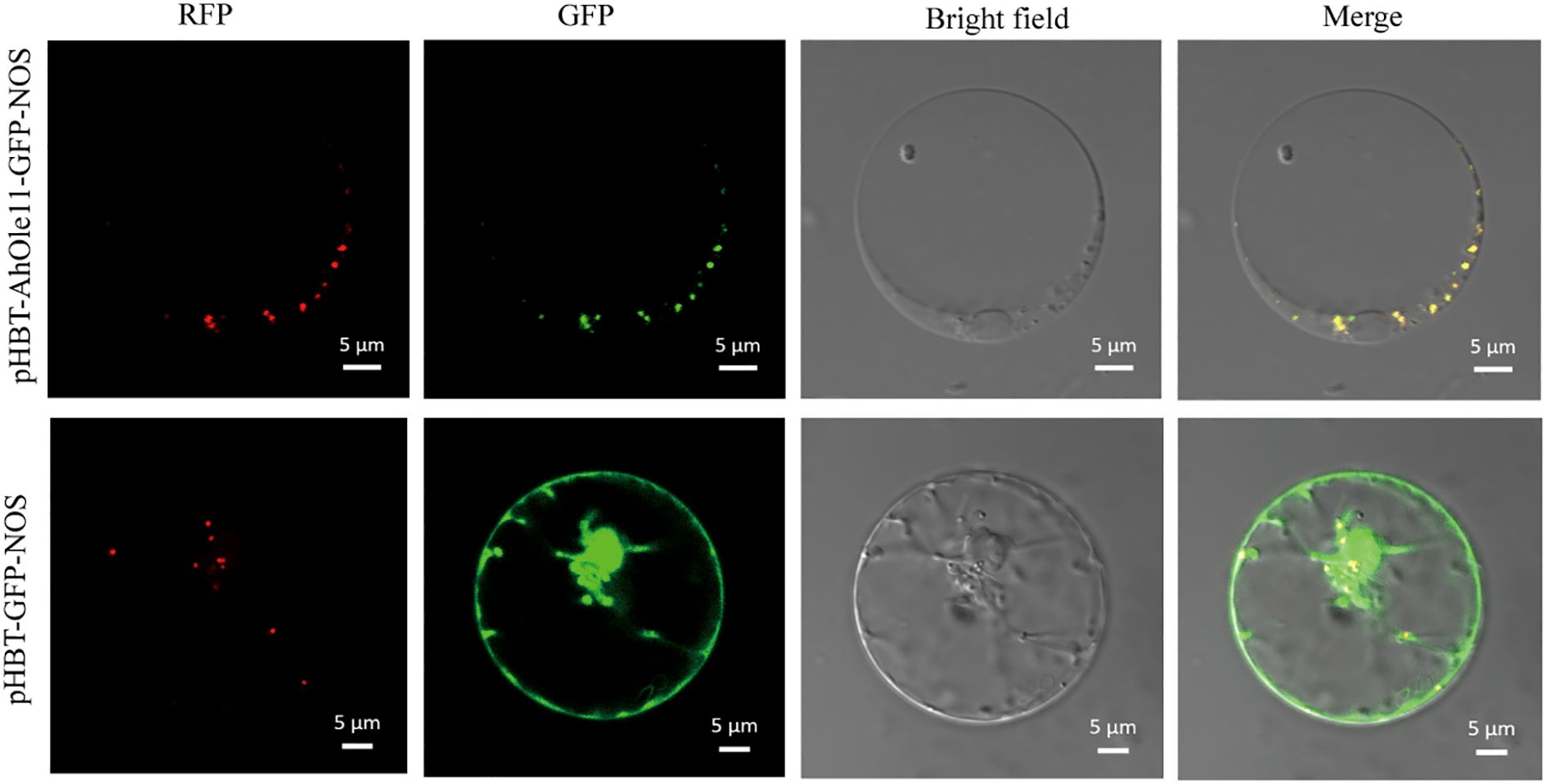 Two rows of microscopy images showing fluorescent and bright-field views. The top row includes red fluorescence protein (RFP), green fluorescence protein (GFP), bright-field, and merged images of a biological sample labeled “pHBT-AhOle11-GFP-NOS.” The bottom row displays similar images labeled “pHBT-GFP-NOS.” Each image has a scale bar indicating 5 micrometers.