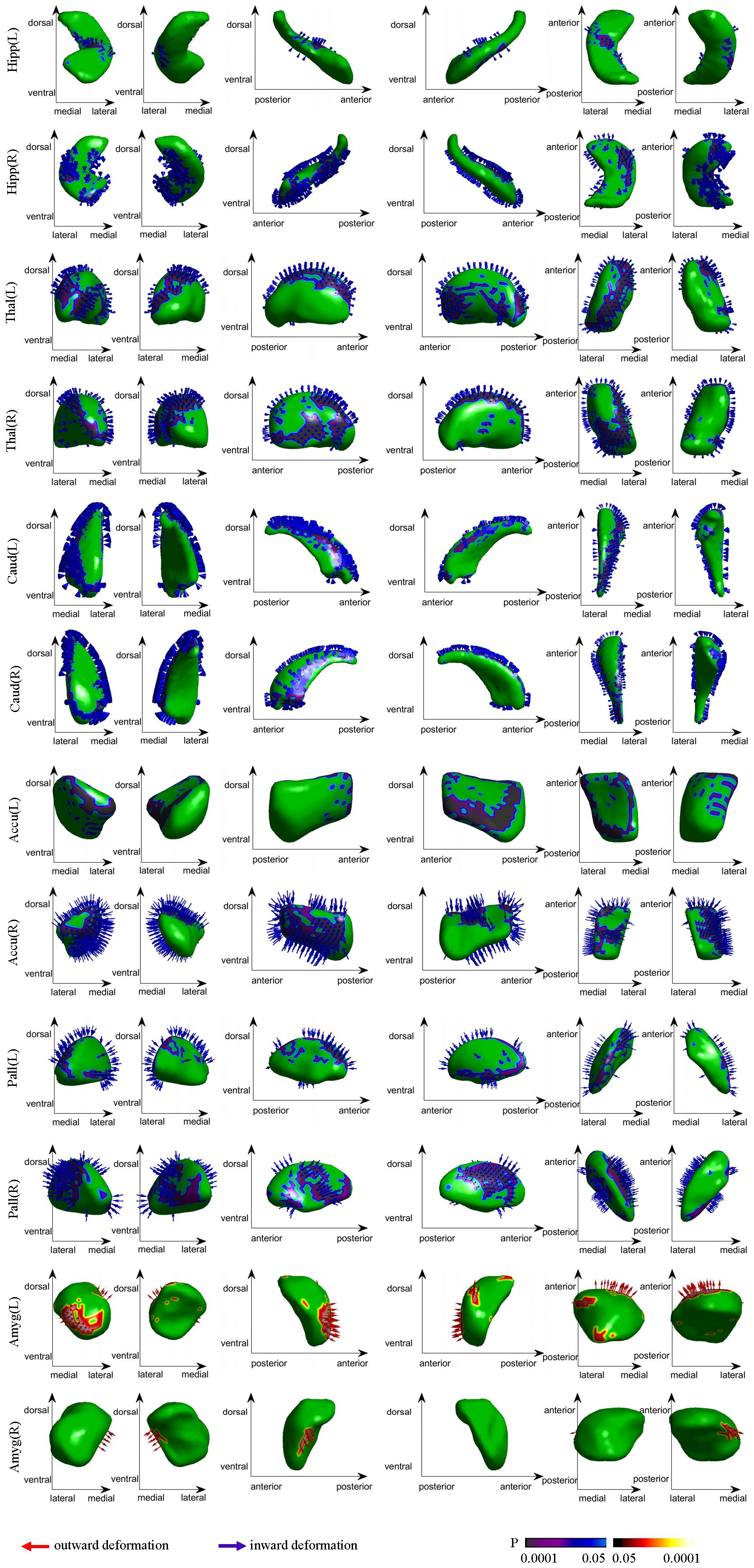 Scientific diagrams display 3D models of various brain structures, including hippocampus, thalamus, caudate, accumbens, pallidum, and amygdala, in different orientations. Arrows depict outward (red) and inward (blue) deformations, with a color scale indicating significance levels from 0.0001 to 0.05. Labels indicate directional axes: dorsal, ventral, anterior, posterior, medial, and lateral.