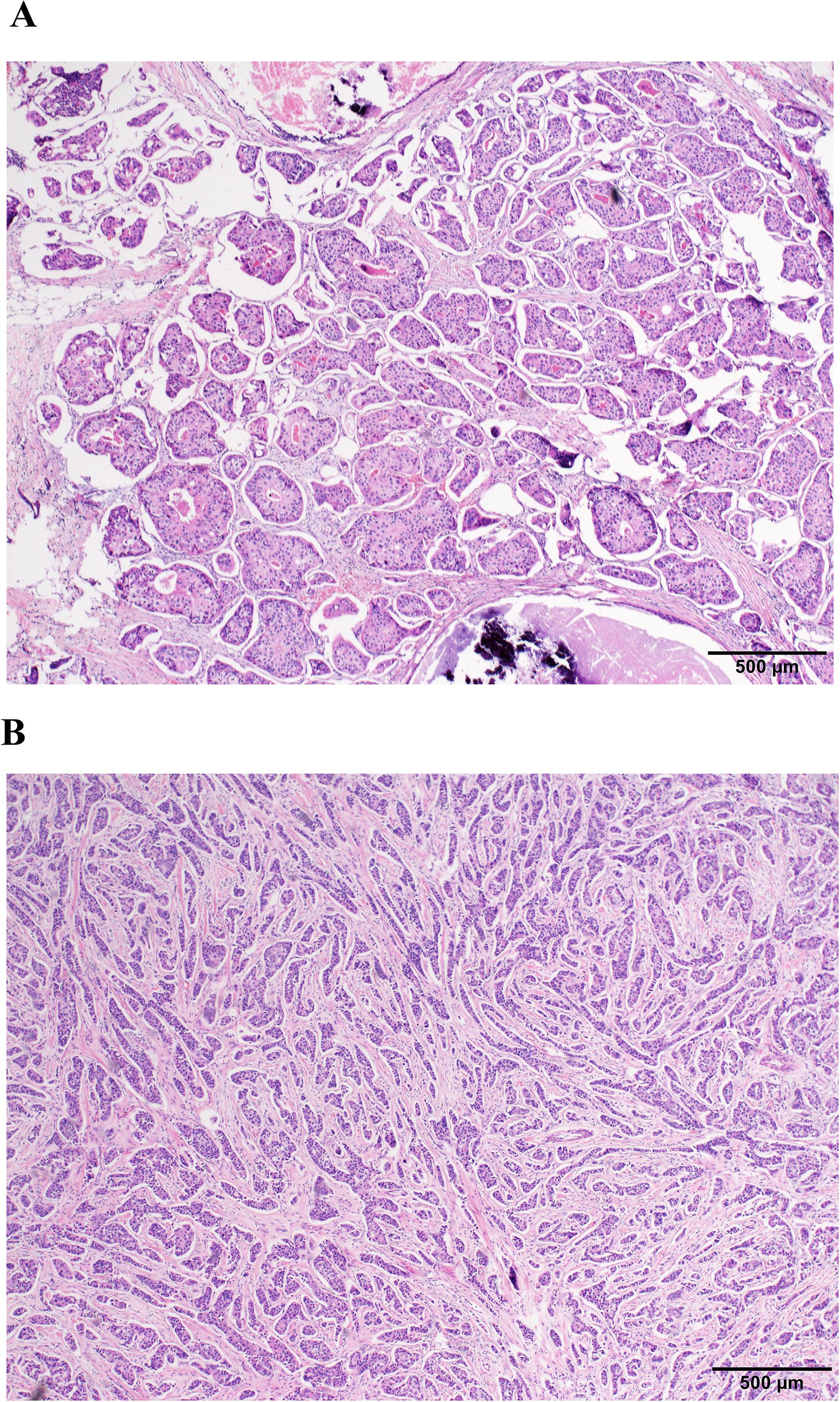 Histological images show two panels labeled A and B. Panel A displays glandular patterns with clustered cells, while Panel B exhibits elongated, fibrous tissue structures. Both images are stained with hematoxylin and eosin, marked with a scale bar of 500 micrometers.