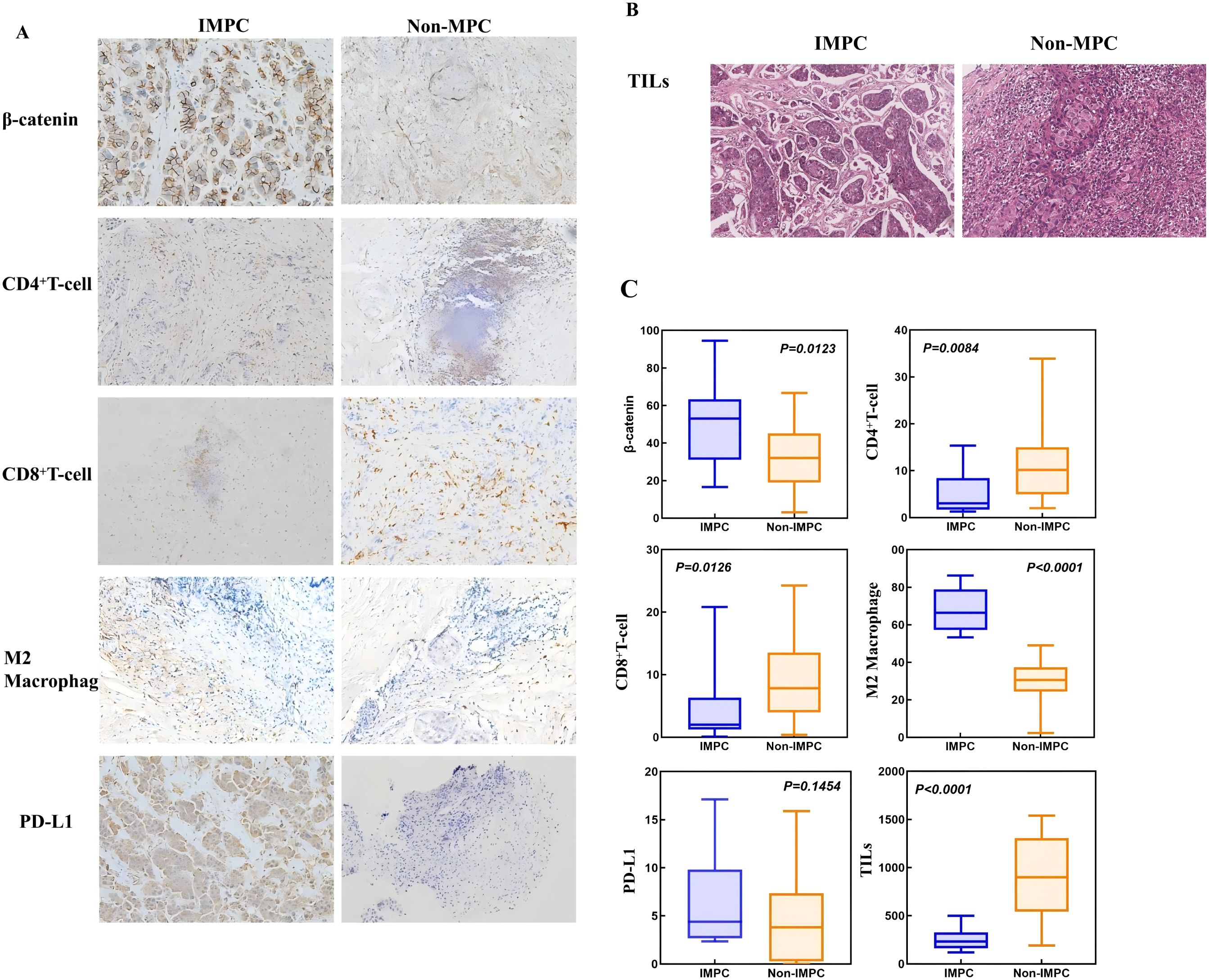 Panel A shows histological comparisons of IMPC and non-MPC tissues stained for β-catenin, CD4+ T-cells, CD8+ T-cells, M2 macrophages, and PD-L1. Panel B displays TILs in IMPC and non-MPC tissues. Panel C presents box plots comparing β-catenin, CD4+ T-cells, CD8+ T-cells, M2 macrophages, PD-L1, and TILs, with statistical significance indicated between IMPC and non-MPC.