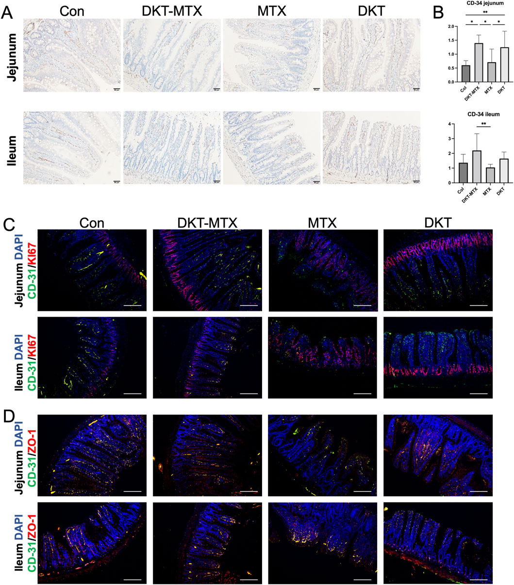 Panel A shows stained sections of jejunum and ileum tissues under conditions: Con, DKT-MTX, MTX, and DKT. Panel B presents bar graphs for CD-34 expression in jejunum and ileum. Panel C includes fluorescence microscopy images showing CD-31 and Ki67 staining in jejunum and ileum under the same conditions. Panel D displays fluorescence images of CD-31 and ZO-1 staining in both tissues. Bars indicate statistical significance in panel B, and the scale bars in panels C and D provide measurement references.