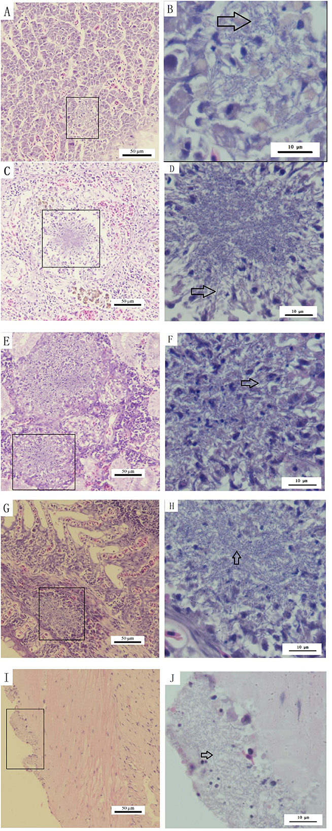 Microscopic images show various stained tissue samples labeled A to J. Images A, C, E, G, and I display wider views with rectangular boxes marking specific areas, while B, D, F, H, and J provide close-up views of these boxed areas. Arrows in B, D, F, H, and J indicate notable cellular features. Different magnifications and scales are visible, highlighting tissue structure and cellular details.