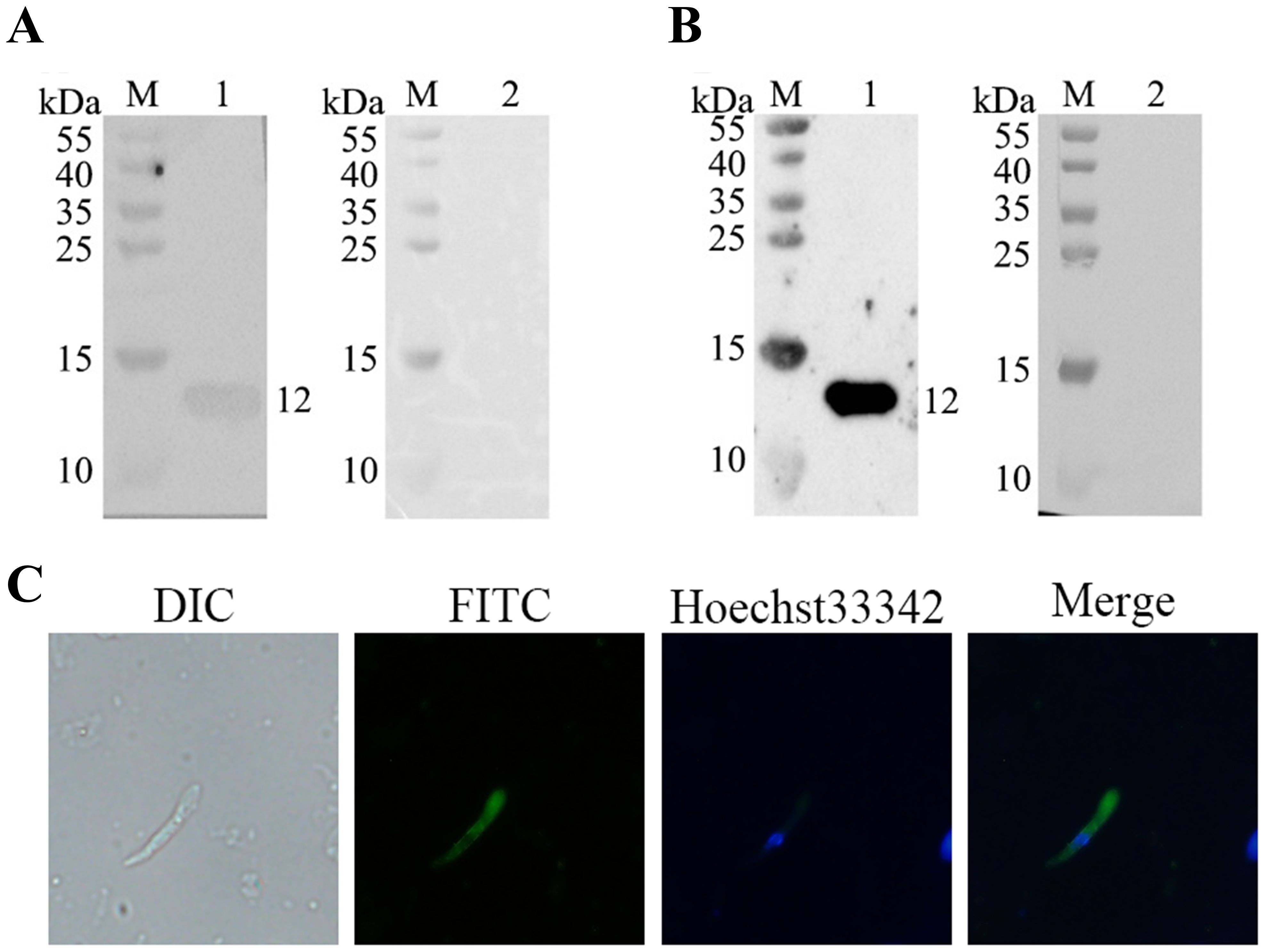 Panel A and B show Western blots with molecular weight markers in kilodaltons, labeled M for markers, and lanes 1 and 2 showing protein bands. In panel C, four micrographs depict a cell under different conditions: DIC, FITC, Hoechst 33342, and a merged image highlighting green fluorescence and blue nuclear staining.