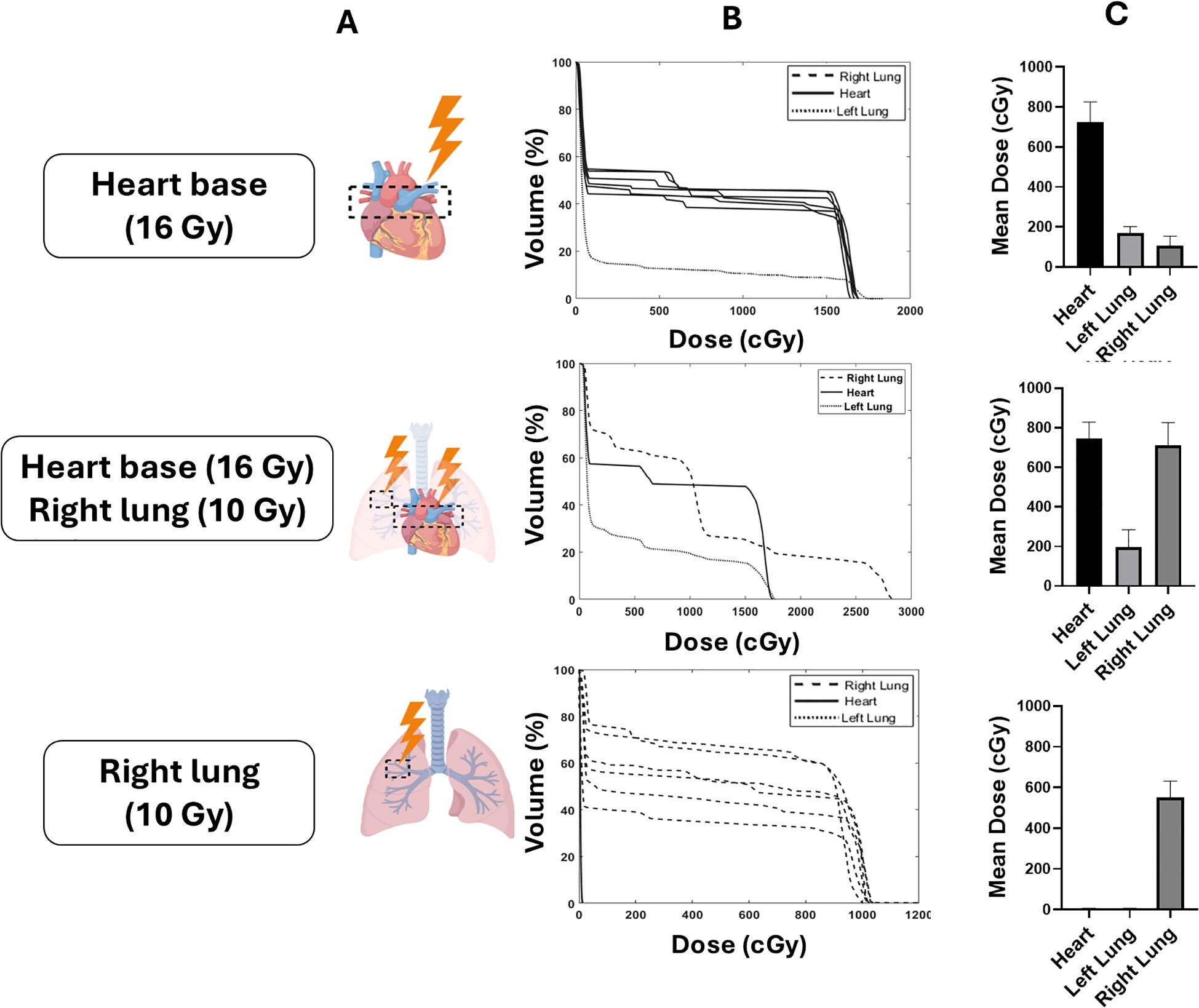 Diagram showing the effect of different radiation doses on heartand lung volumes. Panel A depicts three conditions: heart base with 16 Gy, heart base and right lung with 16 Gy and 10 Gy respectively, and only the right lung with 10 Gy. Panel B includes dose-volume histograms showing the percentage volume of the heart and lungs at various doses. Panel C presents bar graphs of mean doses for the heart, left lung, and right lung under each condition.