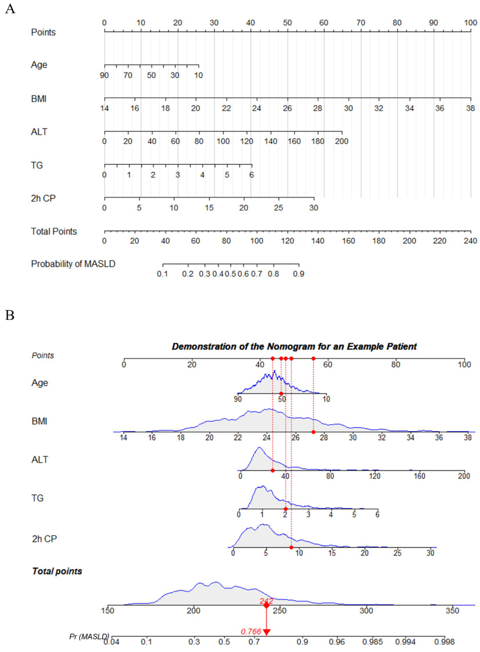 Nomogram for MASLD probability assessment. Image A shows scales for age, BMI, ALT, TG, and 2h CP to calculate total points and MASLD probability. Image B demonstrates use for an example patient, highlighting specific values for each parameter leading to total points and the probability of MASLD, shown as 0.766.