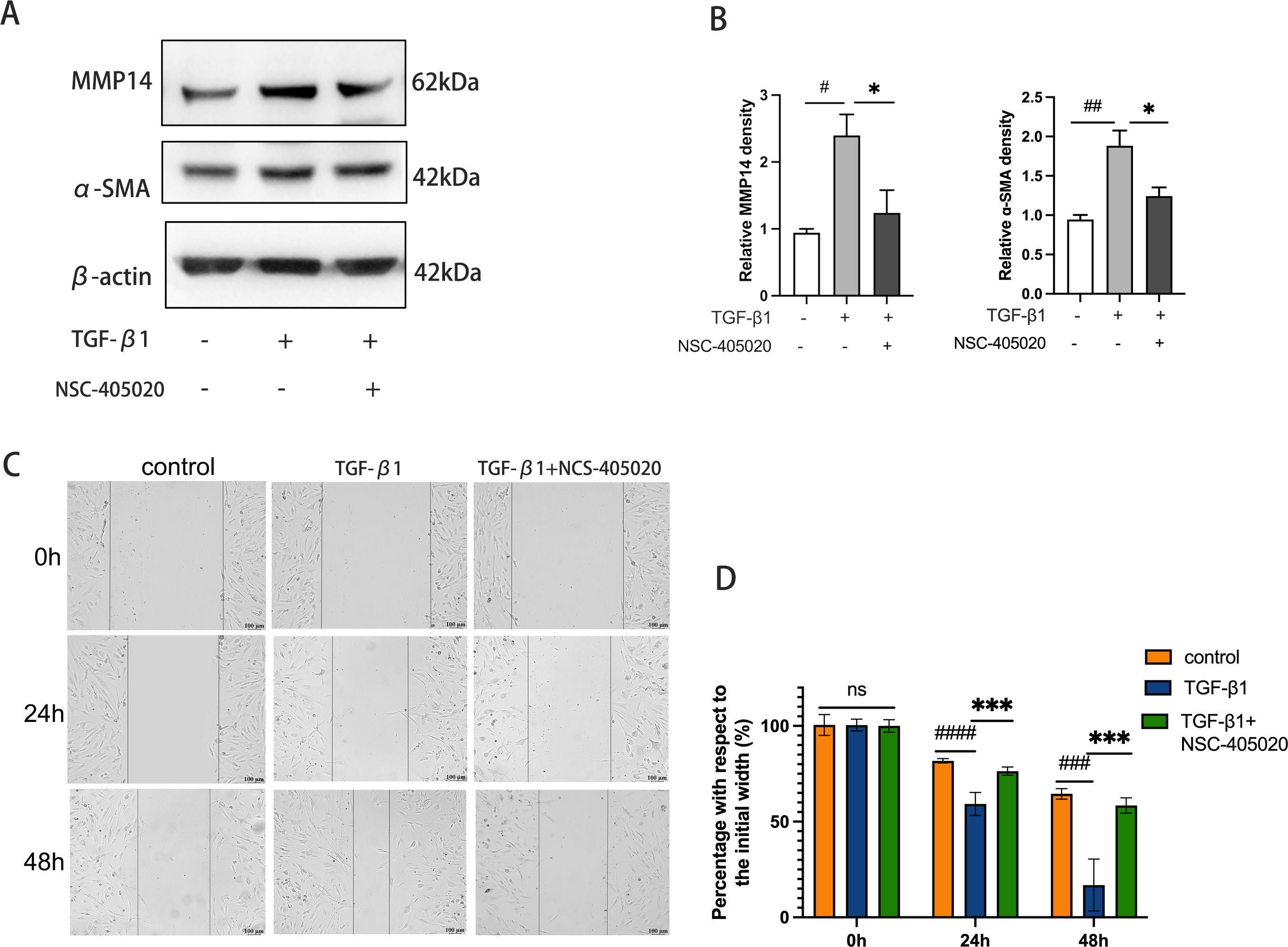 Western blot analysis and graphs showing the effects of TGF-β1 and NSC-405020 on MMP14 and α-SMA expression, alongside cell migration assays. Panel A presents blot bands for MMP14, α-SMA, and β-actin under different treatment conditions. Panel B contains bar graphs showing relative density changes of MMP14 and α-SMA. Panel C provides cell migration images at 0, 24, and 48 hours for control, TGF-β1, and TGF-β1 with NSC-405020 treatments. Panel D displays a bar graph of cell migration percentage relative to initial width across conditions and time points.