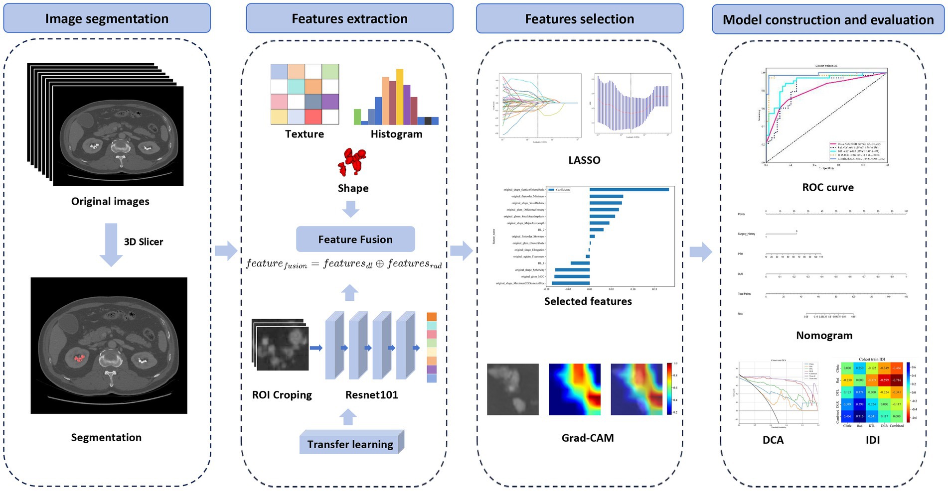 Flowchart illustrating the process of medical image analysis. It consists of four main sections: Image Segmentation, Features Extraction, Features Selection, and Model Construction and Evaluation. Image Segmentation includes original images and segmentation using a 3D slicer. Features Extraction involves texture, histogram, shape analysis, feature fusion, and ResNet101 architecture for transfer learning. Features Selection uses LASSO and selected features visualization. Model Construction and Evaluation includes ROC curve, nomogram, Decision Curve Analysis (DCA), and Integrated Discrimination Improvement (IDI). Each step transitions to the next, with visual representations of the techniques used.