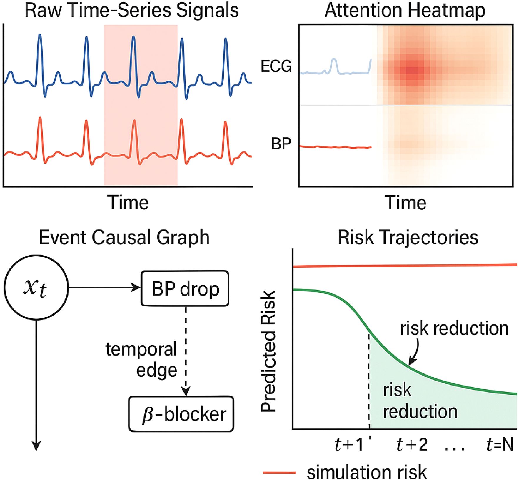 Raw time-series signals display ECG and BP data over time, highlighting an area of interest. The attention heatmap shows concentrations of importance. An event causal graph indicates a BP drop linked to external factors like a β-blocker. Risk trajectories show predicted risk decreasing over time, highlighting risk reduction compared to constant simulation risk.