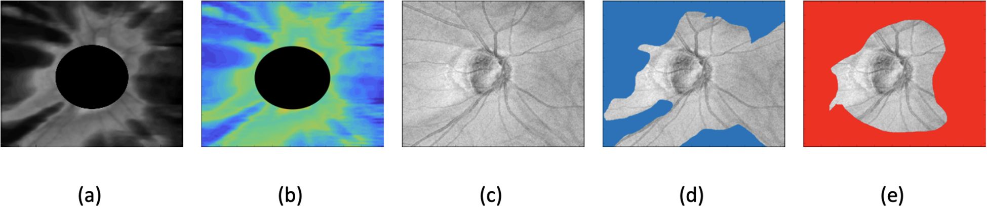 Five-part image illustrating different perspectives of a retinal scan. (a) Grayscale image with a central dark circle. (b) Color-enhanced version with blue and green hues around the circle. (c) Gray-toned retinal image with visible blood vessels. (d) Retinal scan with blue background highlighting the structure. (e) Similar scan with a red background, focusing on contours and vessels.