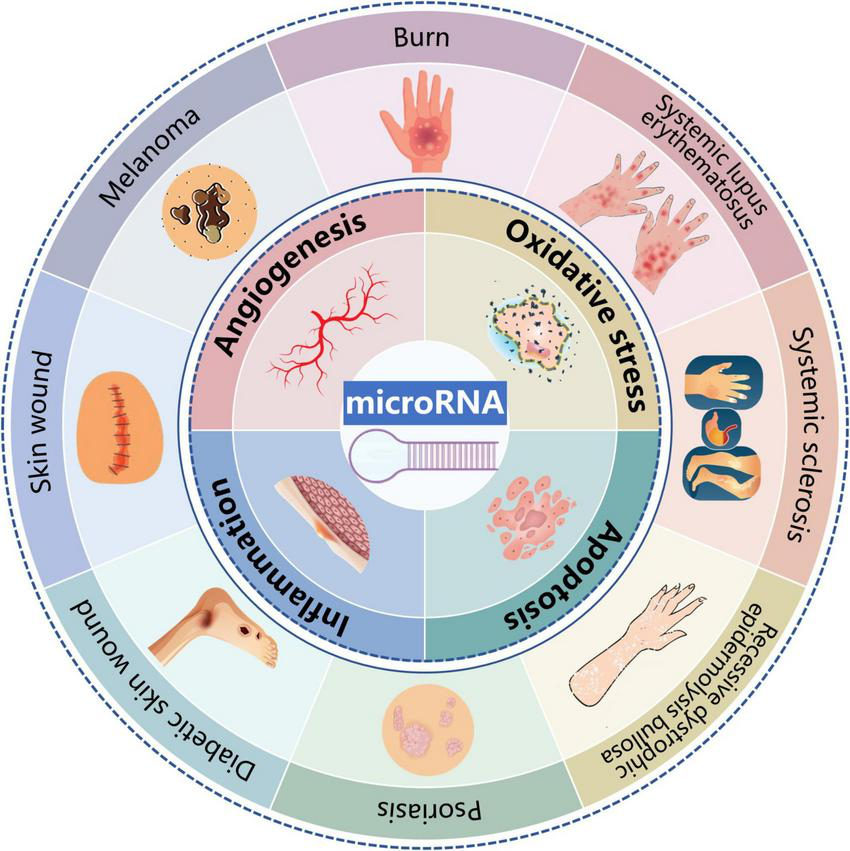 Circle diagram illustrating relationships between microRNA and various conditions. Central circle labeled “microRNA” connects to four sections: Angiogenesis, Oxidative Stress, Apoptosis, and Inflammation. Surrounding images depict conditions like burn, melanoma, systemic lupus erythematosus, systemic sclerosis, and psoriasis.