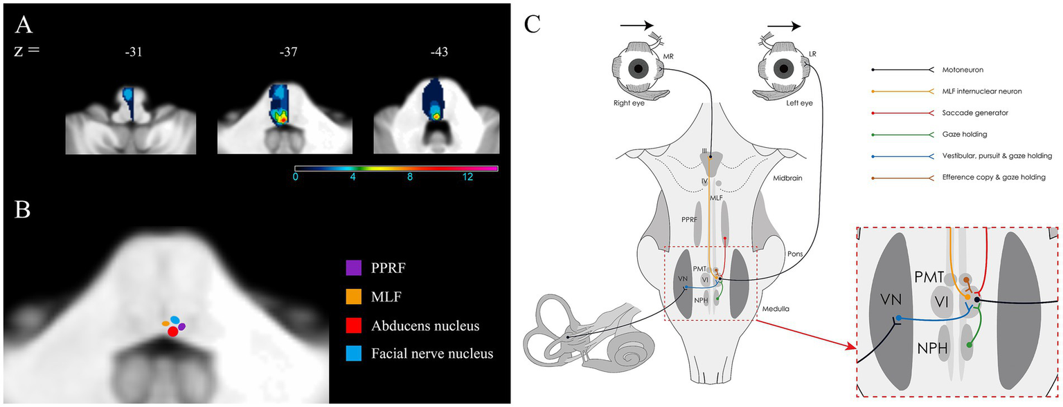 MRI scans in panels A and B highlight brain regions with color codes: purple for PPRF, orange for MLF, red for the abducens nucleus, and blue for the facial nerve nucleus. Panel C is a diagram of ocular motor coordination, with lines indicating motoneurons and various functions such as saccade generation and gaze holding, across the midbrain, pons, and medulla.