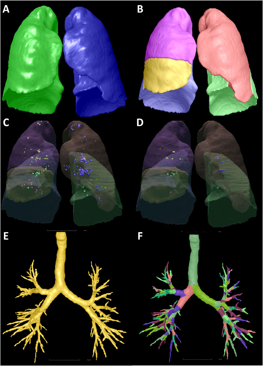 Renderings of lung models and airways. A: Lungs in green and blue. B: Lungs segmented by color—pink, yellow, blue, green. C & D: Lungs with internal structures in various colors. E: Yellow airway model. F: Color-coded branching airway model.