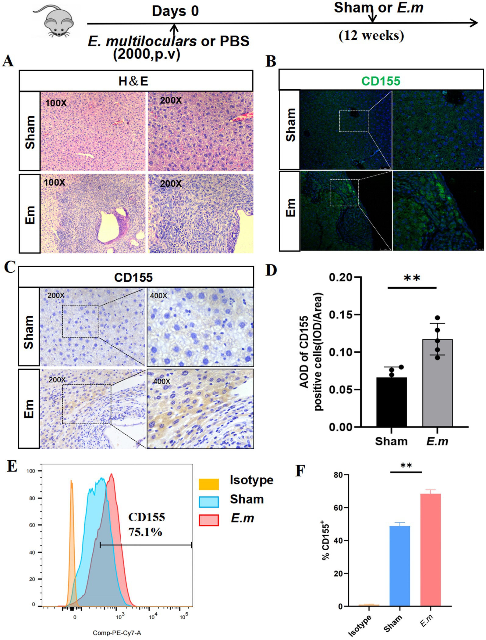 Experimental setup studying E. multilocularis infection in mice over 12 weeks. (A) H&E stained tissue sections at different magnifications. (B) and (C) Staining for CD155, with comparisons between sham and E. multilocularis groups. (D) Bar graph showing average optical density of CD155 positive cells, statistically significant difference indicated. (E) Flow cytometry analysis with histograms for isotype control, sham, and E. multilocularis groups, highlighting CD155 expression at 75.1%. (F) Bar graph showing percentage of CD155 positive cells across groups, with significance markers.