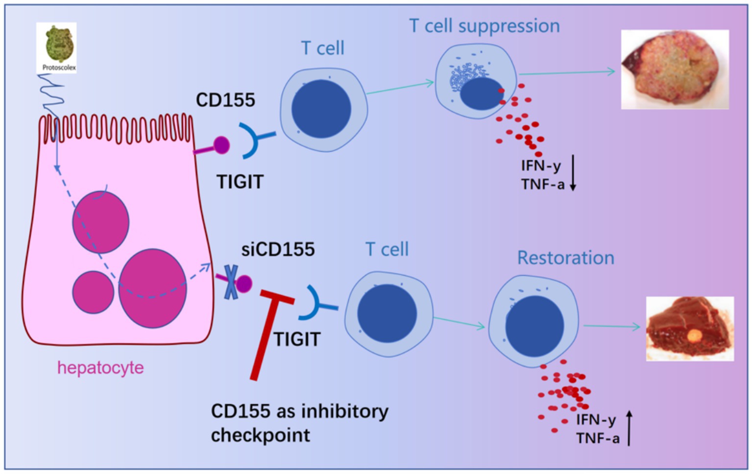 Diagram illustrating T cell interaction with hepatocytes in protoscolex infection. CD155 and TIGIT bind, suppressing T cells and reducing IFN-gamma and TNF-alpha, shown with a damaged tissue image. siCD155 inhibits TIGIT, restoring T cell function, increasing IFN-gamma and TNF-alpha, depicted with healthy tissue.