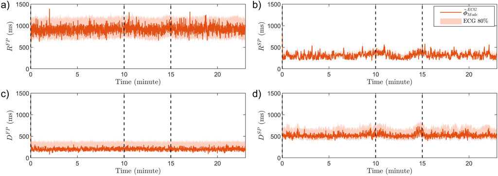 Four graphs labeled a, b, c, and d display various measurements in milliseconds over time in minutes, with vertical dashed lines indicating key moments. Graph a) shows \( R_{FP} \), b) shows \( R_{SP} \), c) shows \( D_{FP} \), and d) shows \( D_{SP} \). All graphs include an orange line representing ECG data with a shaded area for ECG 80% confidence.