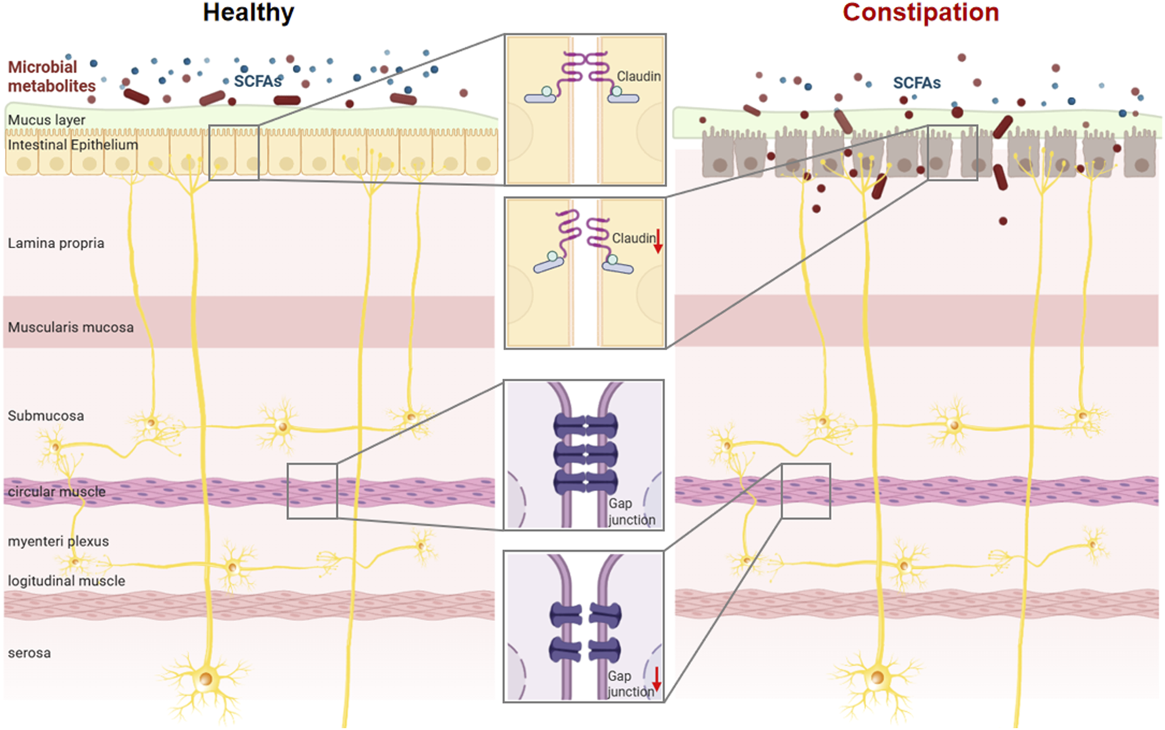 SCFAs are involved in maintaining intestinal barrier integrity and regulating intestinal motility. Compared with the healthy intestinal tract, that in a constipated state exhibits disrupted bacterial flora, reduced short-chain fatty acid synthesis, destruction of intestinal epithelial tissue structure, decreased tight junction integrity, and weakened intestinal motility.