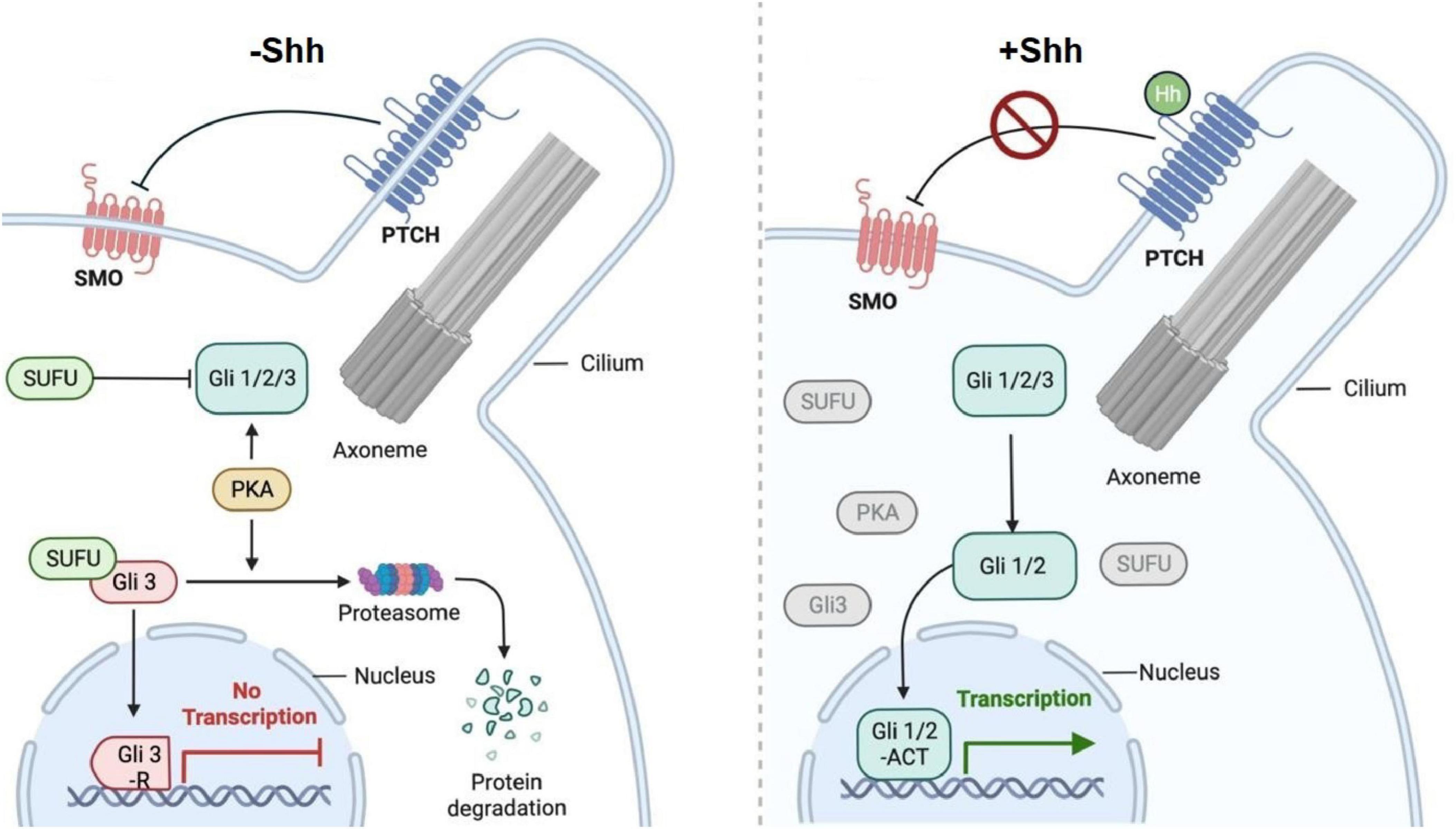 Diagram showing Hedgehog (Hh) signaling pathway in the absence (-Shh) and presence (+Shh) of Sonic Hedgehog. Left side (-Shh): PTCH inhibits SMO, leading to Gli3 degradation and no transcription. Right side (+Shh): Hh binds PTCH, activating SMO, leading to Gli1/2 activation and transcription in the nucleus.