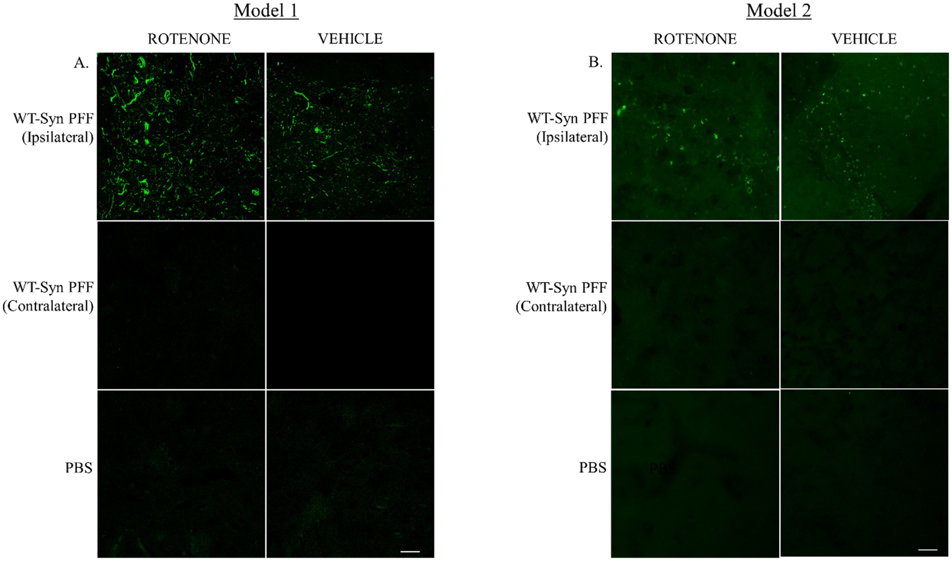 Microscopic images depict signals for phosphorylated synuclein at the injected site (striatum) in PFF injected mice. Model 1 images show WT-Syn PFF (Ipsilateral and Contralateral) and PBS conditions, with brighter fluorescence in ipsilateral with rotenone. Model 2 has similar conditions.