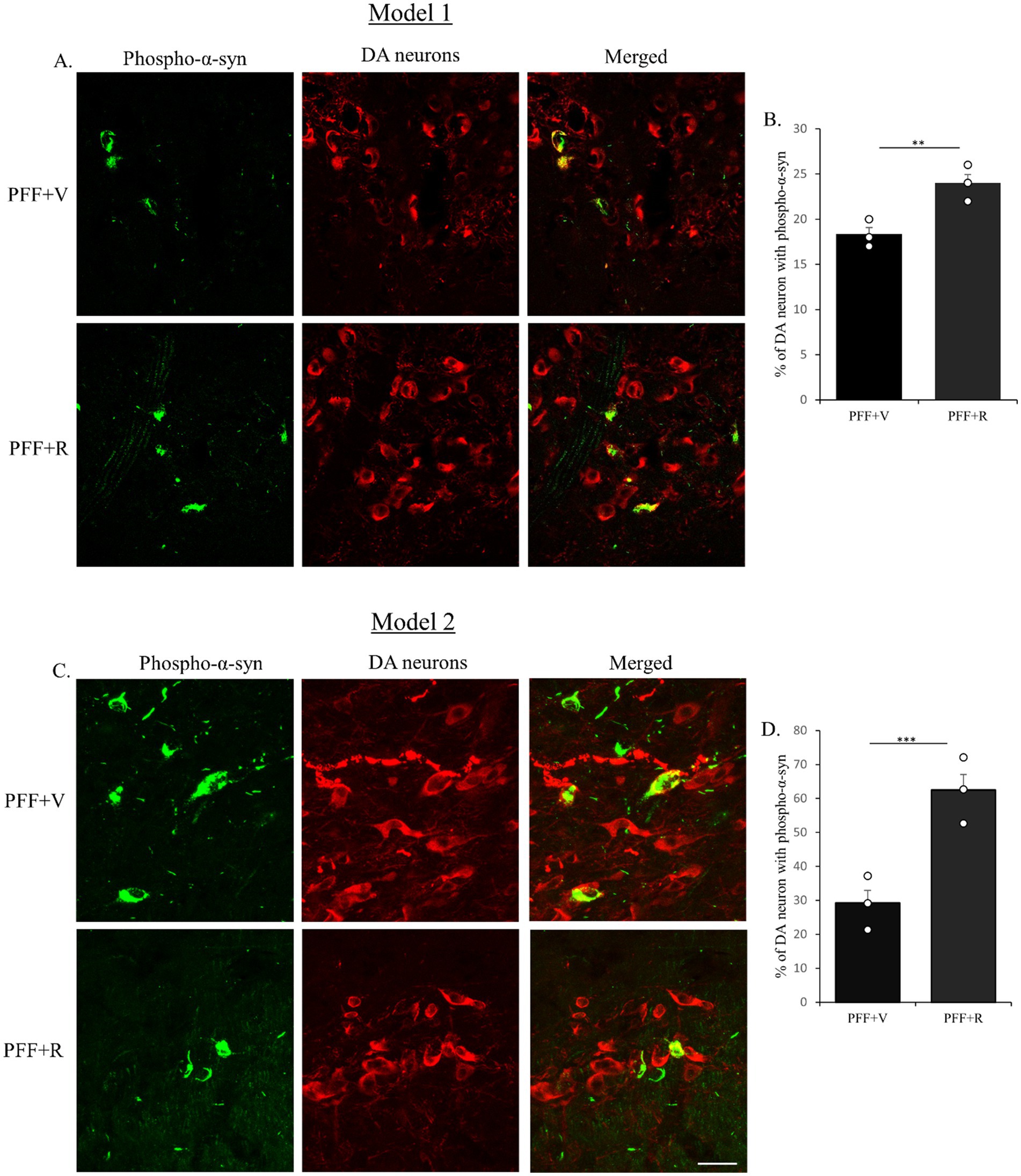 Fluorescence microscopy panels showing phospho-alpha-synuclein (green) and DA neurons (red) in two models. In Model 1, the PFF+R condition shows more phospho-alpha-synuclein than PFF+V. Bar chart B indicates a significant increase in DA neurons with phospho-alpha-syn in PFF+R versus PFF+V. In Model 2, similar results appear, with the PFF+R condition showing more phospho-alpha-synuclein. Bar chart D shows a highly significant increase in DA neurons with phospho-alpha-syn in PFF+R compared to PFF+V.
