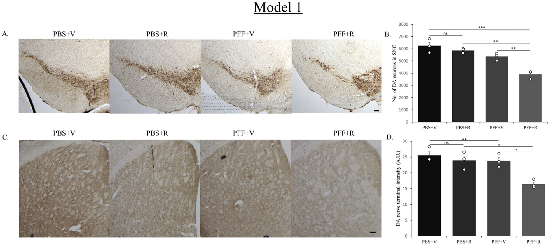 Histological images and bar graphs showing effects in Model 1. Panel A displays stained brain tissue sections under four conditions: PBS+V, PBS+R, PFF+V, and PFF+R. Panel B shows a bar graph comparing the number of dopamine (DA) neurons in the substantia nigra across these conditions, highlighting significant differences with asterisks. Panel C presents additional brain tissue sections similar to Panel A under the same conditions. Panel D provides a bar graph of DA nerve terminal intensity, also showing statistical significance among conditions.