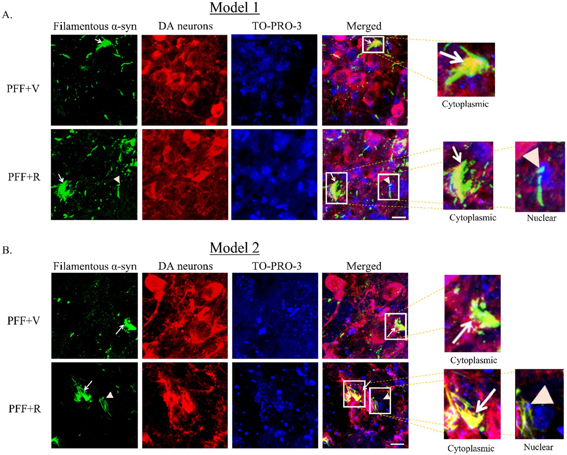Comparison of two models, Model 1 and Model 2, showing different treatments, PFF + V and PFF + R, on filamentous α-synuclein in dopamine neurons. Each row displays three images: α-synuclein (green), dopamine neurons (red), and TO-PRO-3 staining (blue), alongside a merged image. Enlargements indicate cytoplasmic and nuclear localization of α-synuclein. Arrows highlight specific cellular areas in both models for each treatment.