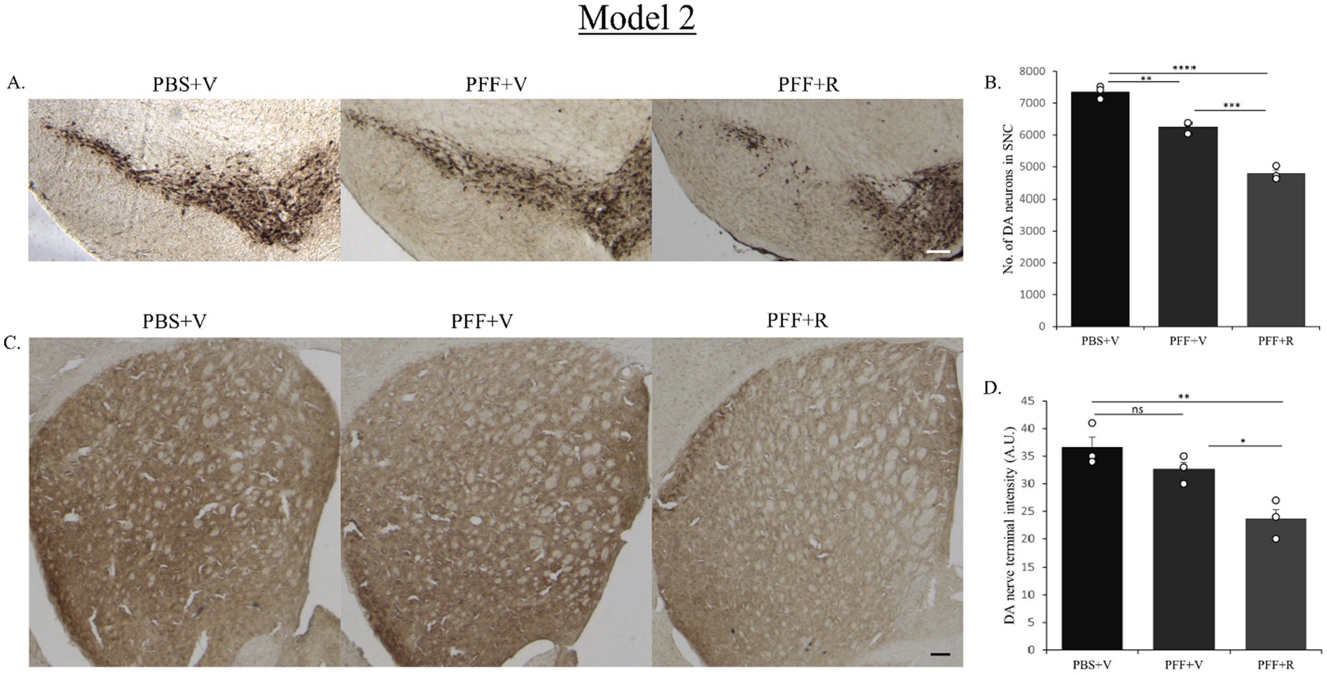 Histological and graphical comparison in Model 2. Panels A and C show histological images of brain tissue under different conditions: PBS+V, PFF+V, and PFF+R. Panels B and D display bar graphs comparing the number of DA neurons in SNC and DA nerve terminal intensity, respectively, across the same conditions. Significant differences are marked with asterisks.