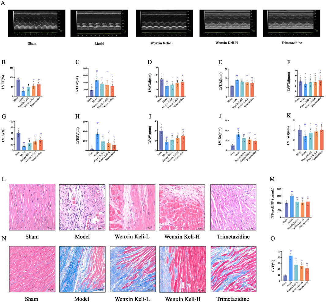 The image contains several panels displaying echocardiogram images, bar graphs, and histological images. Panels A to F show echocardiogram results for different treatments: Sham, Model, Wenxin Keli-L, Wenxin Keli-H, and Trimetazidine. Panels B to K present bar graphs comparing various cardiac parameters across these treatments, such as LVEDV, LVEF, and LV Mass. Panels L and N feature histological images of heart tissue stained to show structural differences between treatments. Panels M and O bar graphs display NT-proBNP and CVF percentages, respectively, illustrating differences between groups.