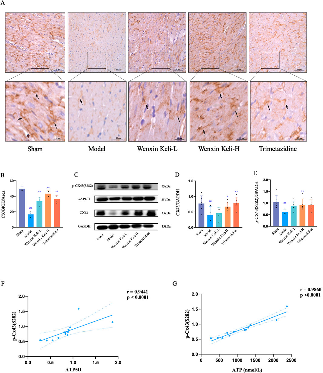 A series of scientific panels displaying experimental data: Panel A shows histological images comparing five treatment groups: Sham, Model, Wenxin Keli-L, Wenxin Keli-H, and Trimetazidine. Panel B presents a bar graph of CX43/OD area across these groups, with statistical annotations. Panel C features Western blot images of protein expressions including p-CX43(S282), GAPDH, and CX43. Panels D and E show bar graphs of CX43/GAPDH and P-CX43(S282)/GAPDH ratios with statistical indicators. Panels F and G provide scatter plots correlating p-CX43(S282) with ATP5D and ATP concentrations, showing strong positive correlations.