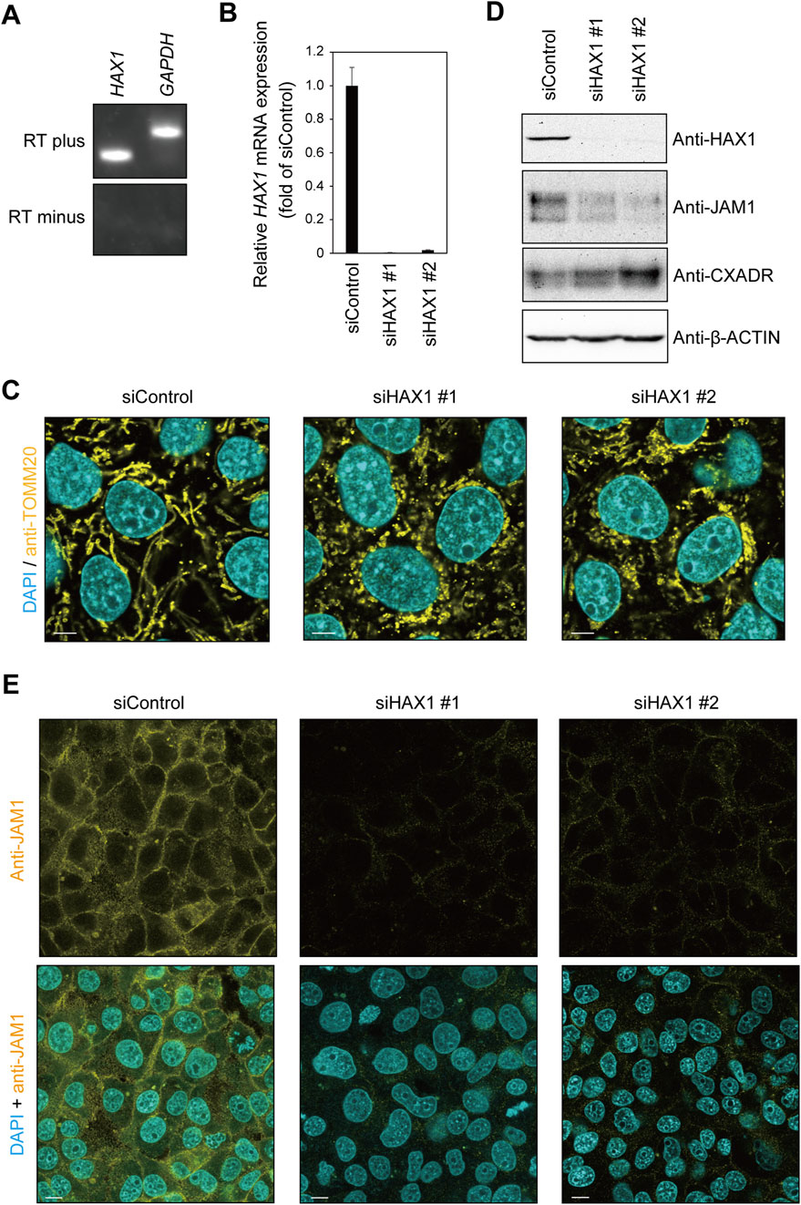 Gel electrophoresis and microscopy images of HAX1 expression. (A) PCR gel showing HAX1 and GAPDH bands, with and without reverse transcription. (B) Bar graph illustrating relative HAX1 mRNA expression levels in control and siHAX1-treated samples. (C) Fluorescence microscopy showing cell staining with DAPI and anti-TOMM20 in control and siHAX1-treated cells. (D) Western blot analysis for HAX1, JAM1, CXADR, and β-Actin across treatments. (E) Immunofluorescence images of cells stained with anti-JAM1, with and without DAPI, in control and siHAX1-treated conditions.