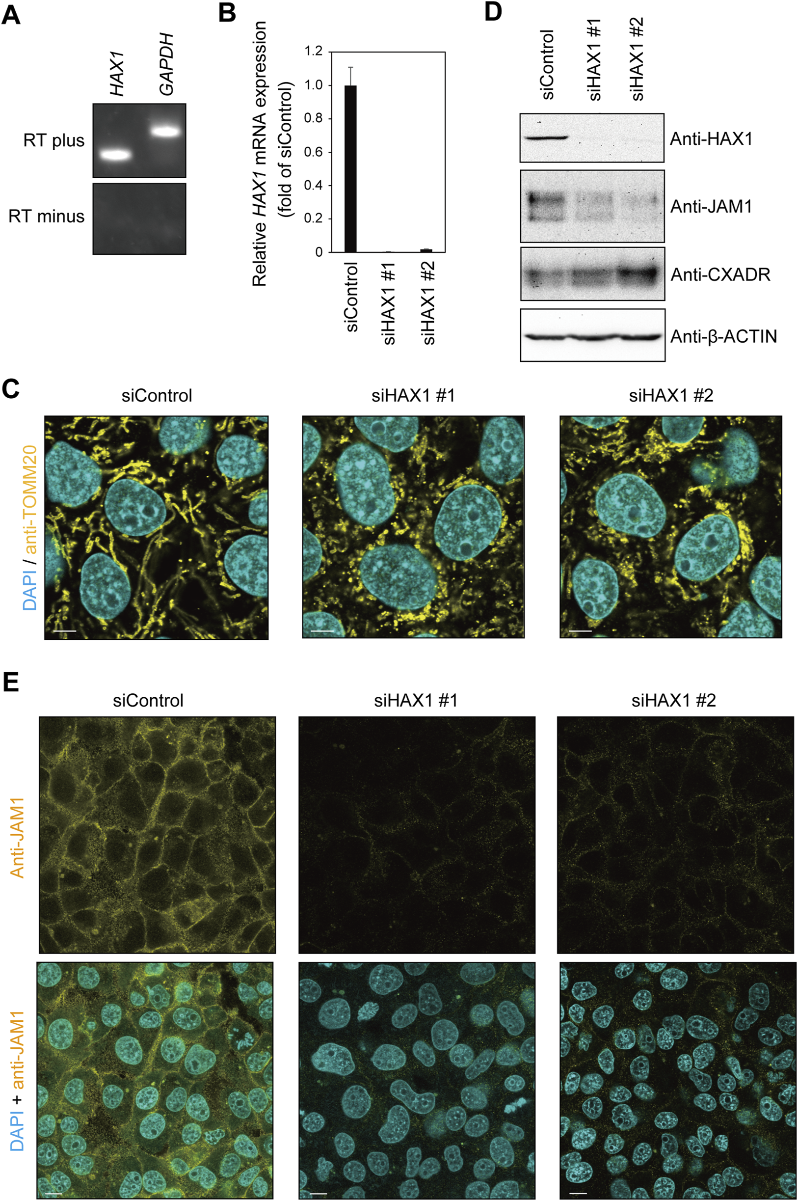 Gel electrophoresis and microscopy images of HAX1 expression. (A) PCR gel showing HAX1 and GAPDH bands, with and without reverse transcription. (B) Bar graph illustrating relative HAX1 mRNA expression levels in control and siHAX1-treated samples. (C) Fluorescence microscopy showing cell staining with DAPI and anti-TOMM20 in control and siHAX1-treated cells. (D) Western blot analysis for HAX1, JAM1, CXADR, and β-Actin across treatments. (E) Immunofluorescence images of cells stained with anti-JAM1, with and without DAPI, in control and siHAX1-treated conditions.