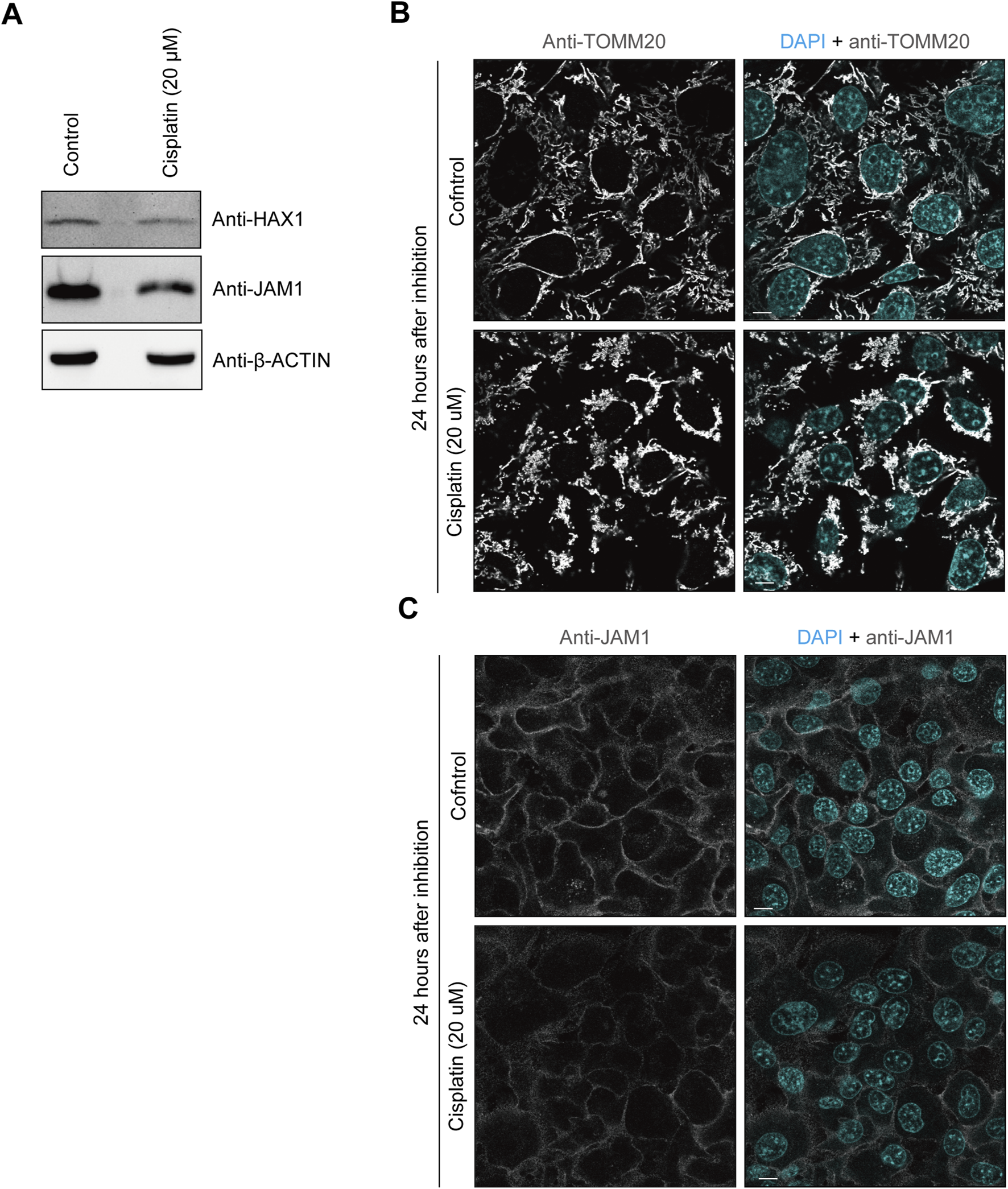 Panel A shows Western blot results for anti-HAX1, anti-JAM1, and anti-β-ACTIN under control and cisplatin-treated conditions. In panel B, immunofluorescence images display Anti-TOMM20 staining with and without DAPI in control and cisplatin-treated cells at 24 hours. Panel C shows Anti-JAM1 staining with and without DAPI in similar conditions.