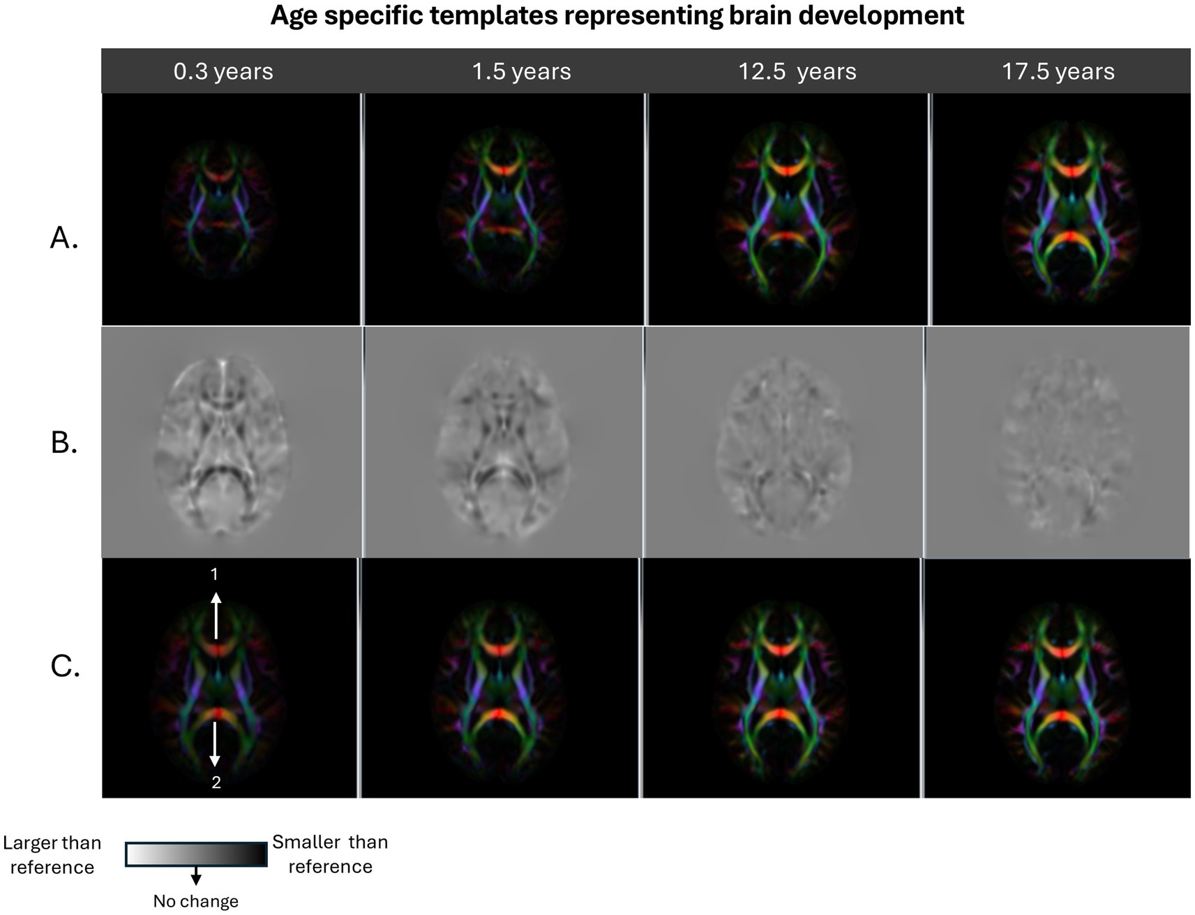 Brain development is depicted through age-specific templates at 0.3, 1.5, 12.5, and 17.5 years. Row A shows the directionally encoded color maps for each age-specific template. Row B shows the determinant of the Jacobian maps generated from registering each group to the reference template. This provides an estimate of the regional size change information. Row C shows each age group template transformed into the young adult template space. Legend shows the interpretation key for dark and bright voxels in the Row B images, denoting an increase or decrease in size of the structures in comparison to the adult template.
