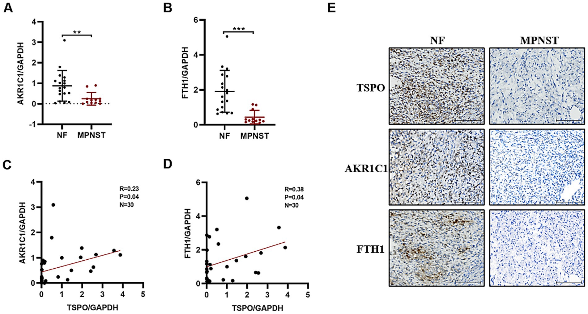 Graphs and immunohistochemical images compare NF and MPNST samples. Graphs A and B show expression levels of AKR1C1/GAPDH and FTH1/GAPDH, with significant differences indicated. Graphs C and D show correlations between TSPO/GAPDH and AKR1C1/GAPDH or FTH1/GAPDH. Panel E features TSPO, AKR1C1, and FTH1 staining in NF and MPNST tissues, with noticeable staining differences. Scale bars present.