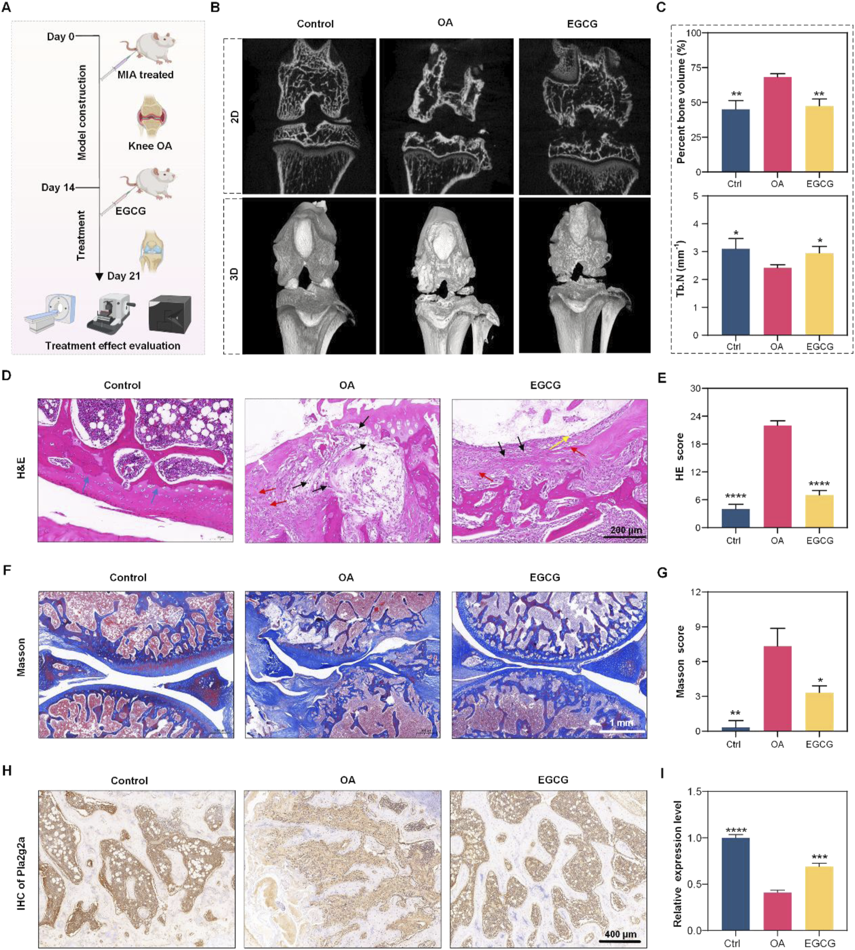 Experiment overview with multiple panels displays osteoarthritis (OA) research. Panel A describes the experimental timeline with mice undergoing different treatments, including MIA and EGCG. Panel B shows 2D and 3D images comparing bone structures in control, OA, and EGCG-treated groups. Panel C includes graphs showing bone volume and thickness data. Panel D presents H&E stained tissue images, while panel E provides H&E scores. Panel F shows Masson-stained images, and panel G includes Masson scores. Panel H displays IHC images of Pnliprp2 expression, and panel I presents its relative expression levels.
