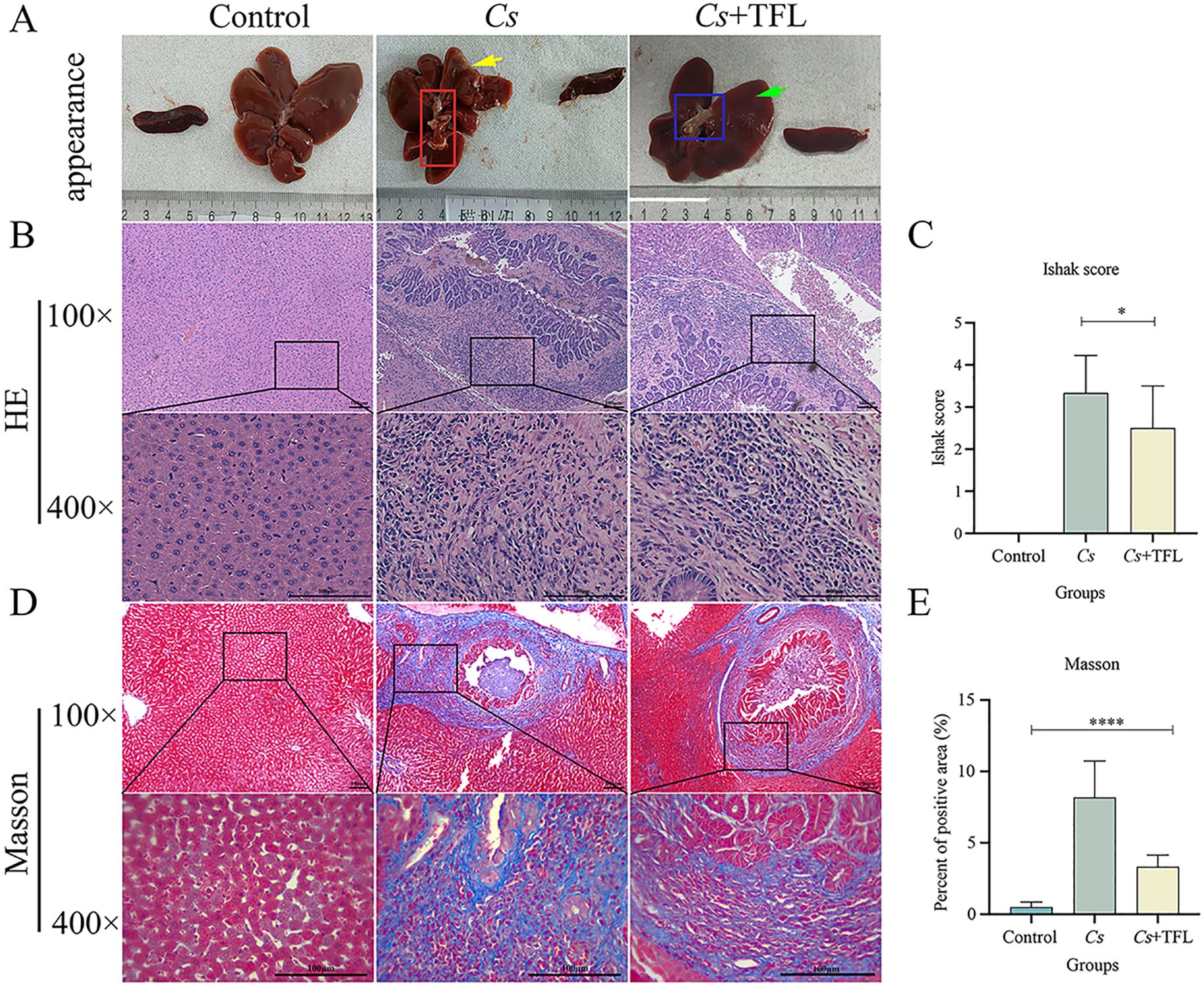 Panel A shows the physical appearance of livers from control, Cs, and Cs+TFL groups. Panel B displays liver histology via HE staining at 100x and 400x magnifications. Panel D shows Masson staining at the same magnifications. Panel C is a bar graph depicting Ishak scores among groups, with Cs group having a higher score than Cs+TFL. Panel E is a bar graph showing Masson staining positive area percentage, with the Cs group significantly higher than Cs+TFL. Measurements in the graphs are accompanied by statistical significance indicators.