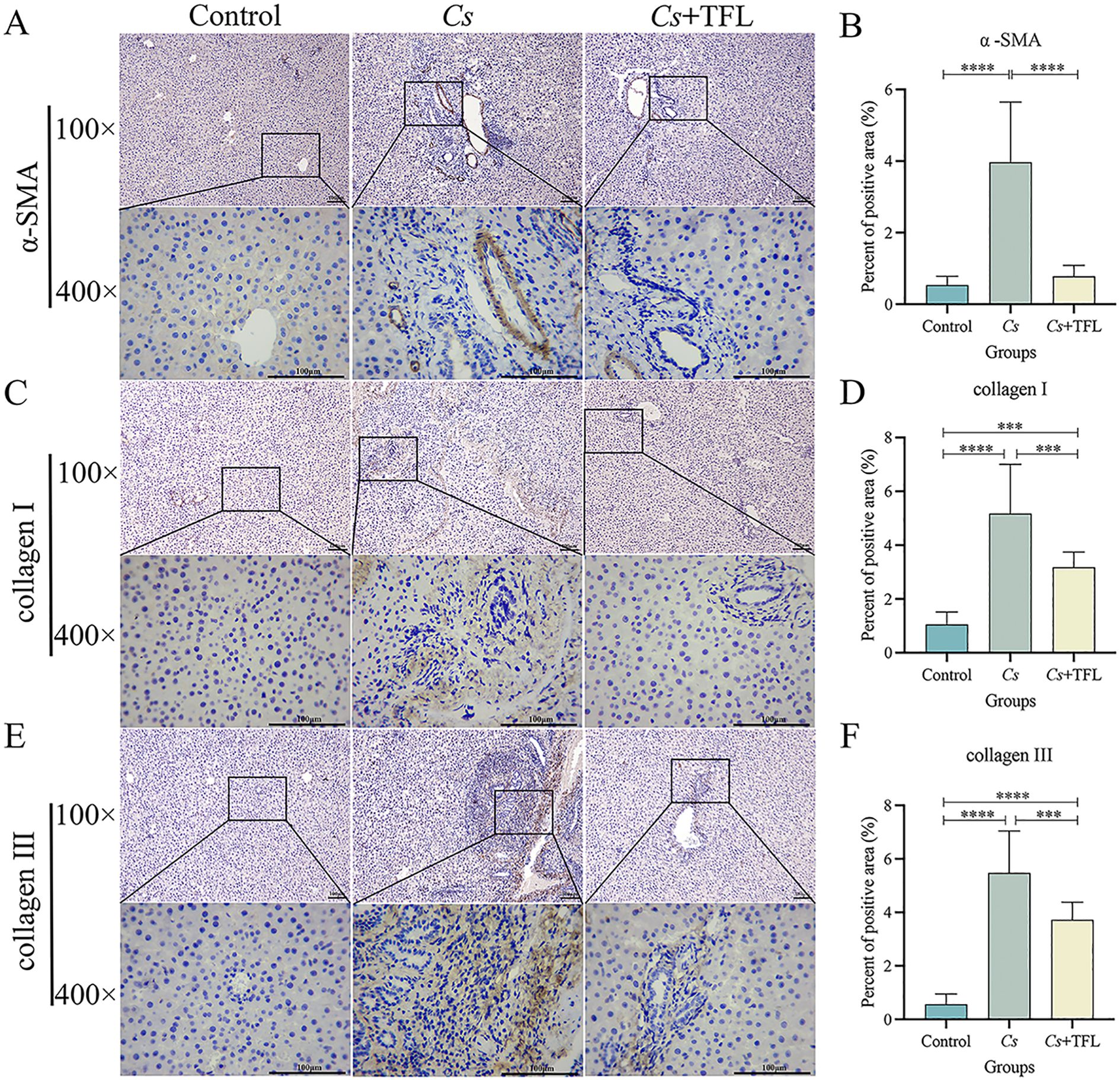 Histological analysis and bar graphs comparing control, Cs, and Cs+TFL groups. Panels A, C, and E show tissue staining for α-SMA, collagen I, and collagen III at 100x and 400x magnification, with distinct differences in staining intensity among groups. Panels B, D, and F present bar graphs indicating the percentage of positive stained area for each marker. Cs group shows the highest staining, while Cs+TFL shows reduced staining compared to Cs. Statistical significance is indicated with asterisks.