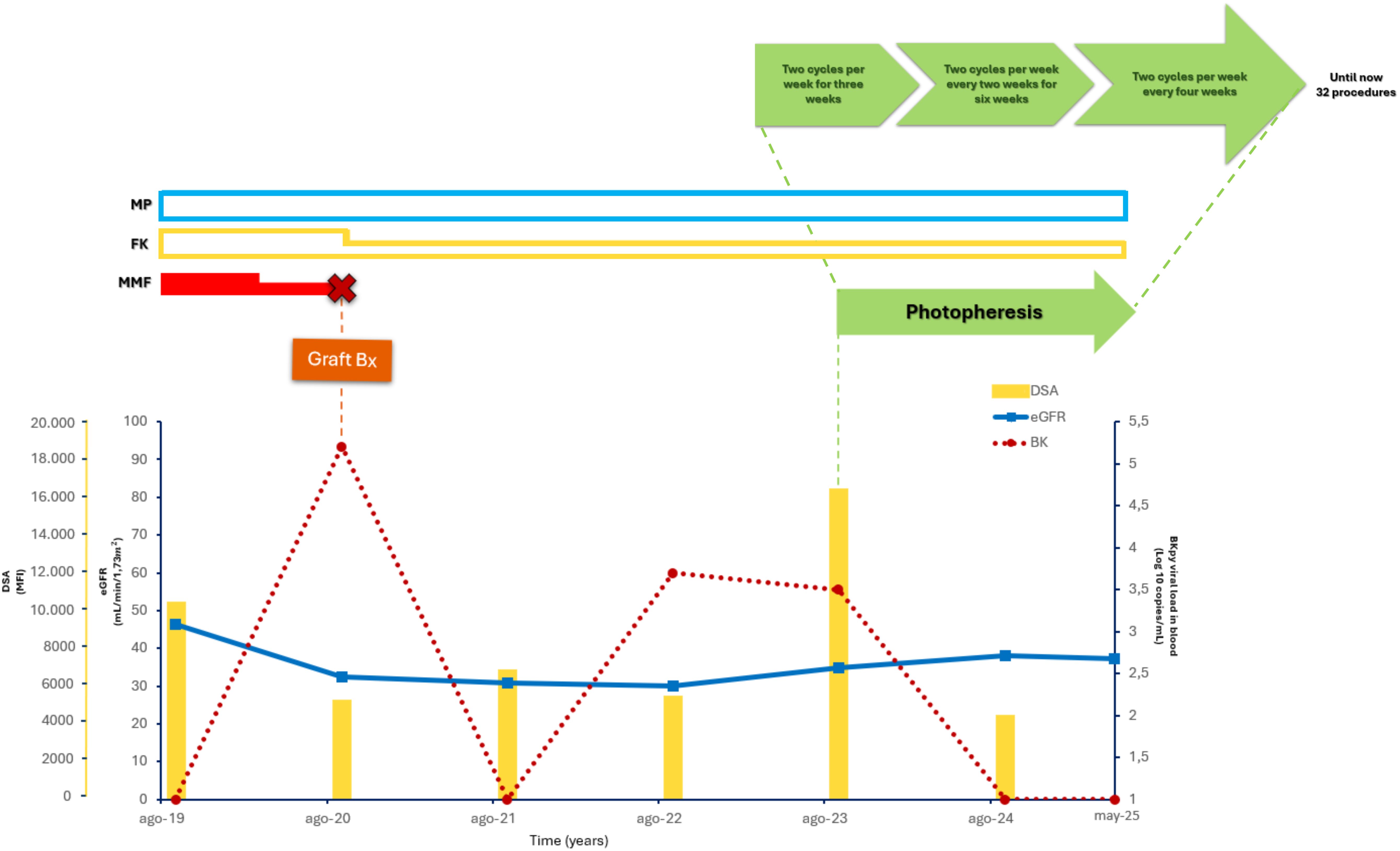 Chart illustrating immunosuppressive therapy over time with three treatments: MP, FK, and MMF. A graft biopsy is highlighted at a peak in BK level. Additionally, it tracks changes in DSA, eGFR, and BK levels, alongside a photopheresis timeline with varying frequency.