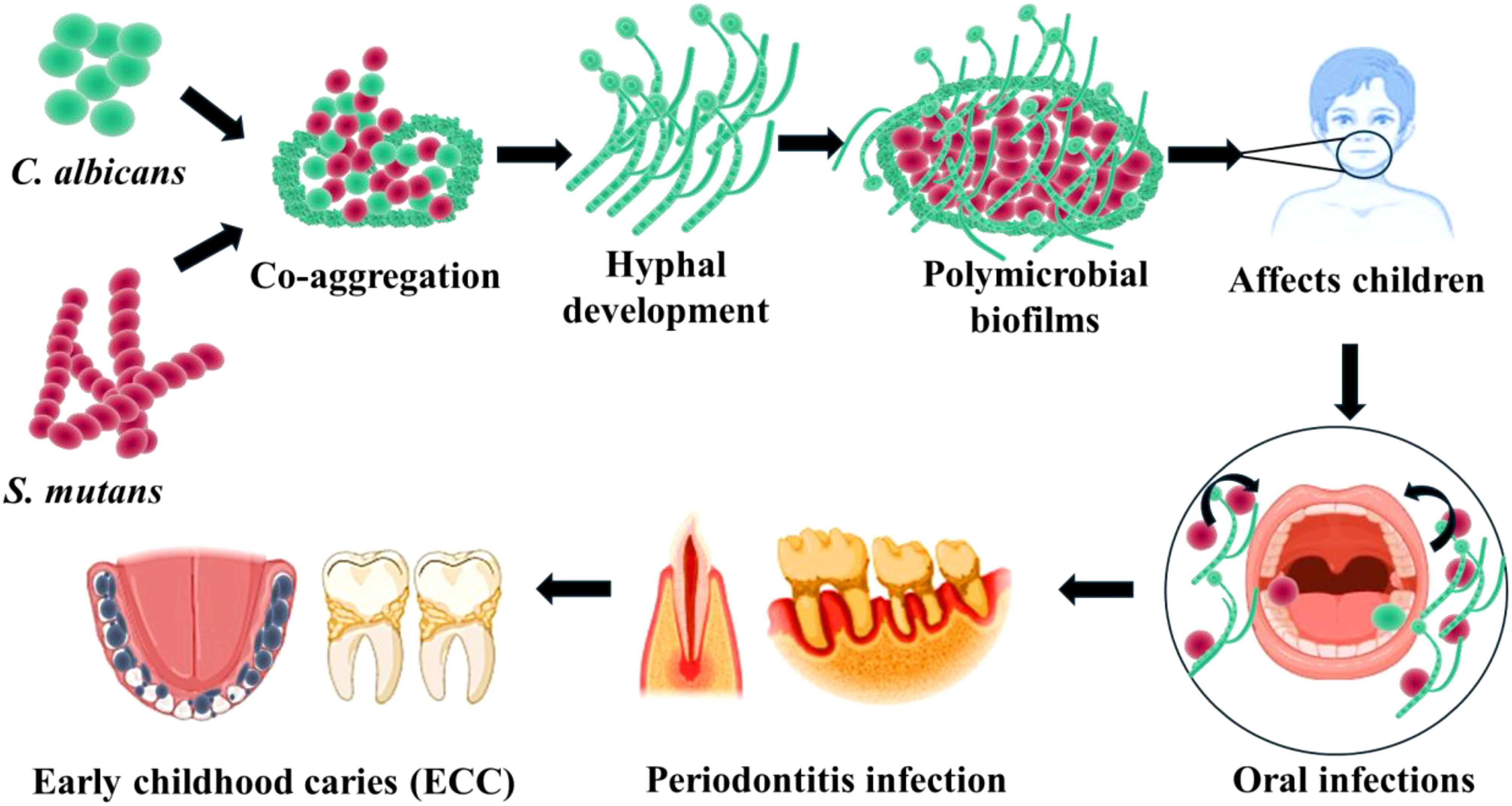 Illustration showing the process of co-aggregation between C. albicans and S. mutans, leading to hyphal development and polymicrobial biofilms. The biofilms affect children, causing oral infections like early childhood caries (ECC) and periodontitis. Arrows indicate the progression from co-aggregation to infection stages.