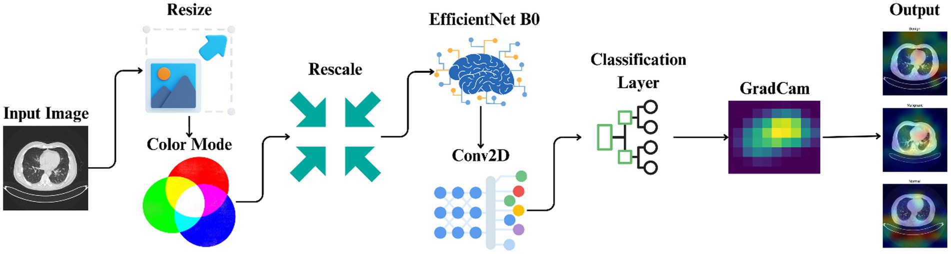 Flowchart illustrating a process using a CT scan as input. Image is resized and processed in color mode, then rescaled before passing through EfficientNet B0 and a Conv2D layer. It goes through a classification layer, using GradCAM to produce outputs categorizing the scan as benign, malignant, or normal, with corresponding images shown for each category.