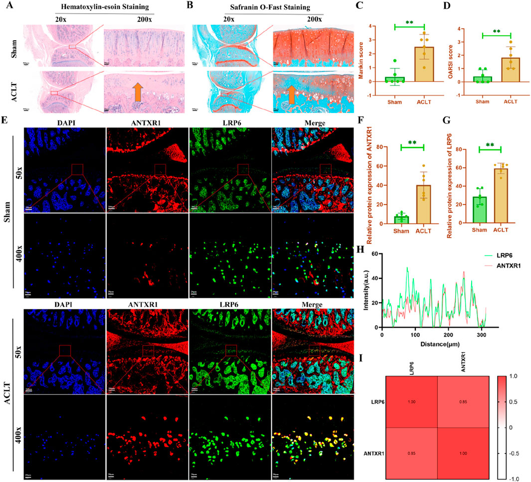 Microscopic and analytical comparison of sham and ACLT samples. Panels A and B show Hematoxylin-eosin and Safranin O-Fast staining at 20x and 200x magnification, highlighting structural differences. Panels C and D present bar graphs comparing Mankin and OARSI scores between sham and ACLT samples, showing significant differences. Panel E displays immunofluorescent staining images of DAPI, ANTXR1, LRP6, and merged views at different magnifications for both conditions. Panels F and G are bar graphs showing relative protein expression levels of ANTXR1 and LRP6. Panel H is a line graph of protein intensity over distance. Panel I shows a correlation heatmap for LRP6 and ANTXR1.
