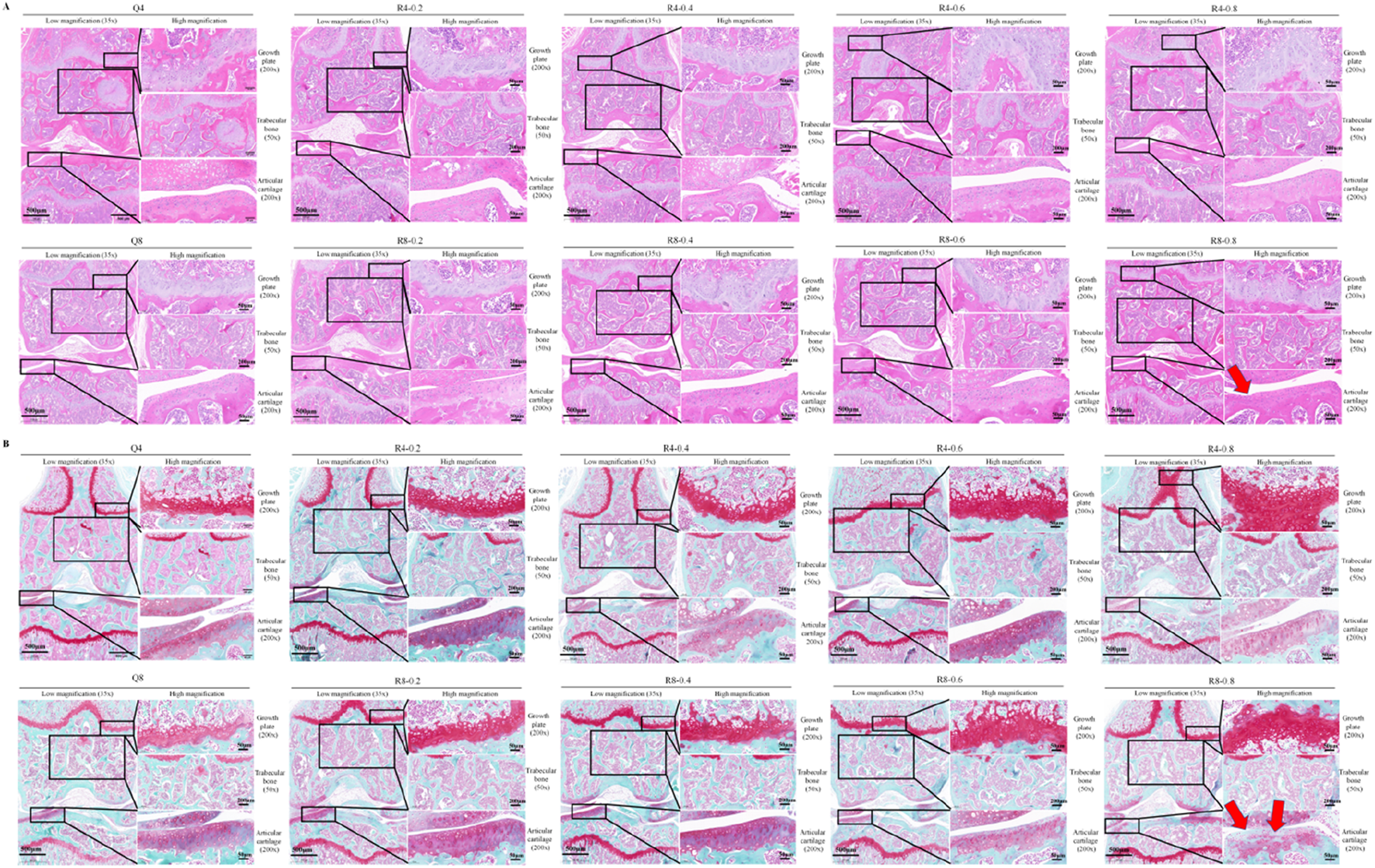 Microscopic images in grids show bone tissue at low and high magnifications. Panel A depicts H&E staining; Panel B shows a different stain highlighting structures like growth plates and trabecular bone. Labels indicate magnification levels and specific areas, such as articular cartilage. Arrows mark notable features.