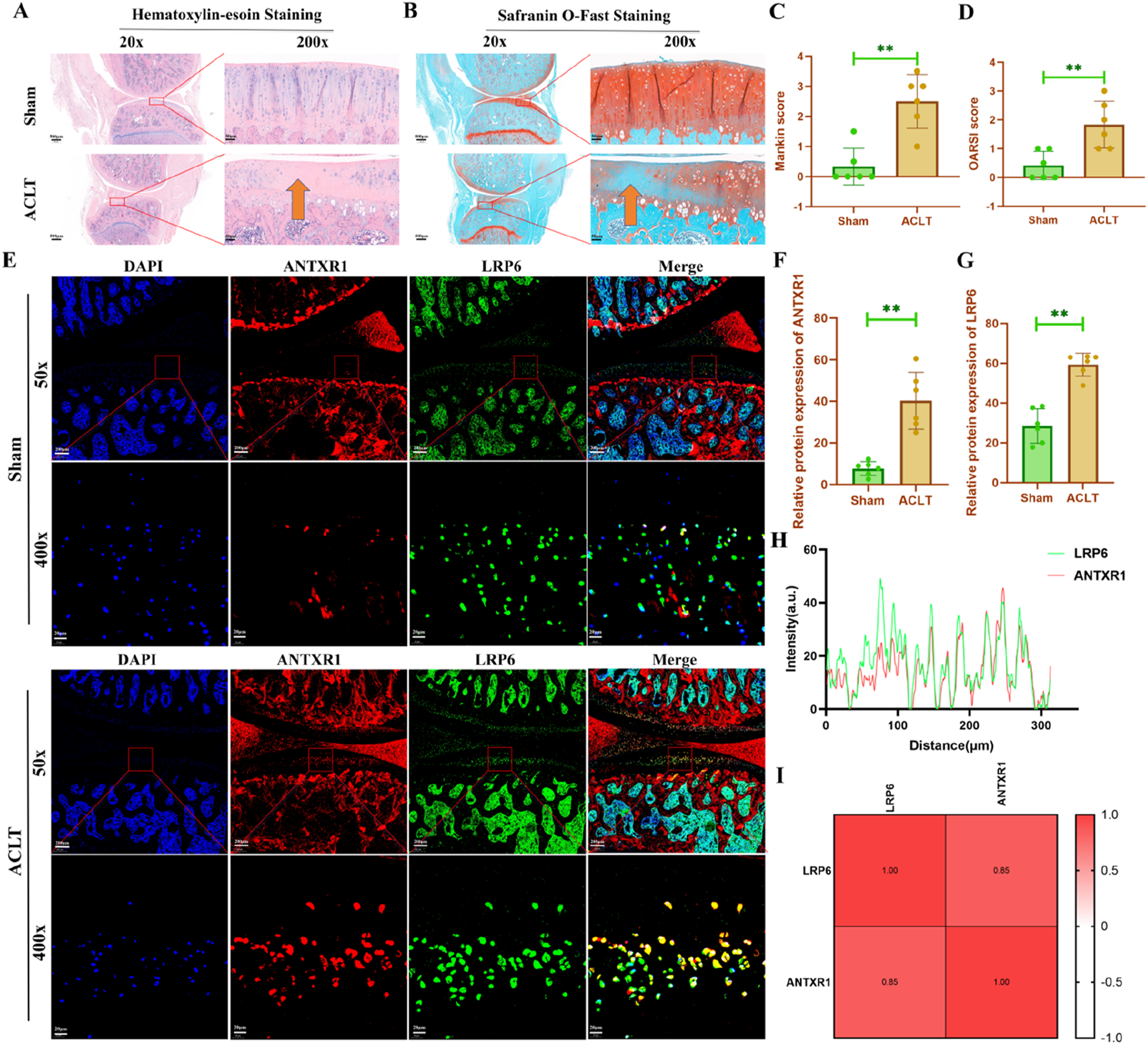Microscopic and analytical comparison of sham and ACLT samples. Panels A and B show Hematoxylin-eosin and Safranin O-Fast staining at 20x and 200x magnification, highlighting structural differences. Panels C and D present bar graphs comparing Mankin and OARSI scores between sham and ACLT samples, showing significant differences. Panel E displays immunofluorescent staining images of DAPI, ANTXR1, LRP6, and merged views at different magnifications for both conditions. Panels F and G are bar graphs showing relative protein expression levels of ANTXR1 and LRP6. Panel H is a line graph of protein intensity over distance. Panel I shows a correlation heatmap for LRP6 and ANTXR1.