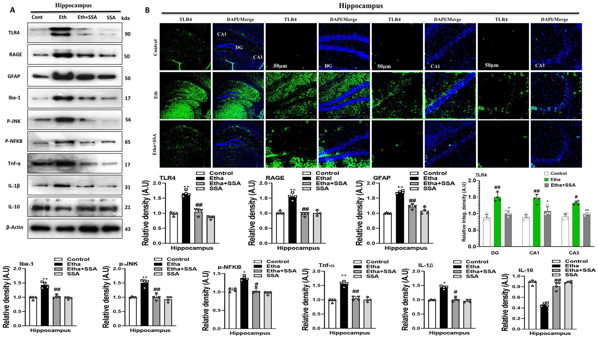 Western blot and immunofluorescence images showing protein expression in the hippocampus under different treatments: Control, Eth, Eth+SSA, SSA. Proteins analyzed include TLR4, RAGE, GFAP, Iba-1, P-JNK, P-NFKB, Tnf-α, IL-1β, and IL-10. Immunofluorescence images show TLR4 expression with DAPI staining for cell nuclei. Bar graphs indicate relative protein density, with significant changes denoted. Treatments affect protein expression, with statistical variations indicated by symbols. Scale bars in immunofluorescence images are 50 micrometers.