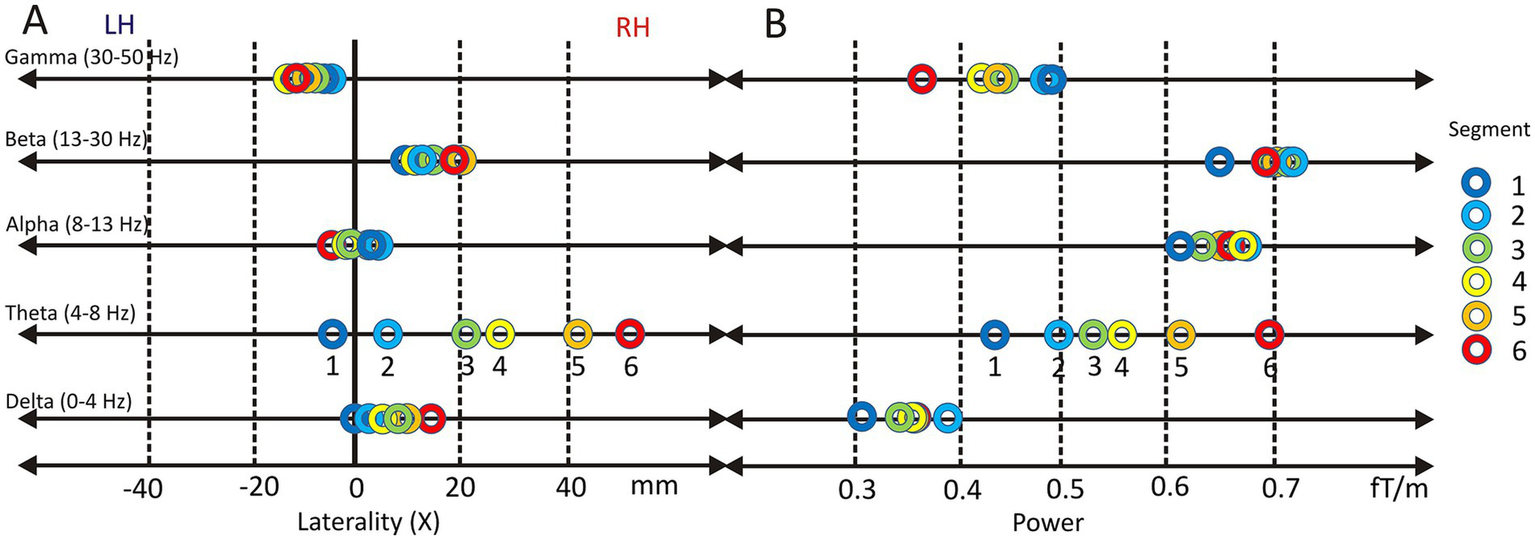 Graph A and B compare laterality versus power across five frequency bands: Gamma, Beta, Alpha, Theta, and Delta. Circles labeled one to six represent segments, with colors blue to red denoting different segments. Arrows indicate left hemisphere (LH) and right hemisphere (RH) directions.