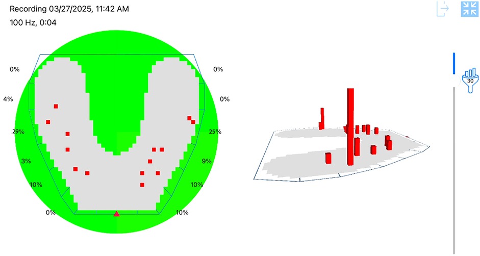 Radar and 3D bar graph images show data recorded on 03/27/2025 at 11:42 AM. The radar graph depicts percentages ranging from zero percent to twenty-nine percent with red squares on a green background. The 3D graph displays red vertical bars of varying heights on a gray grid.